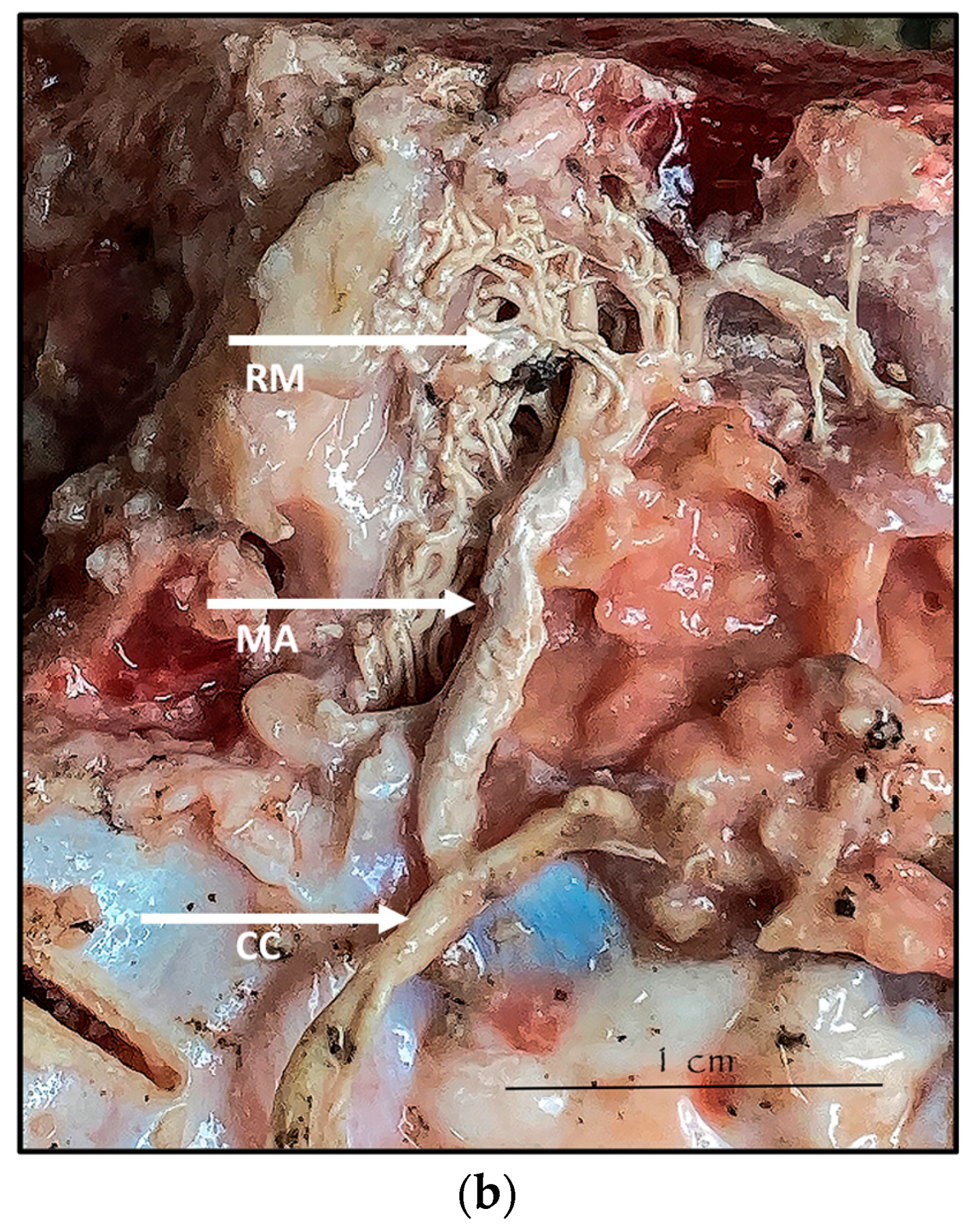 Anatomia 02 00013 g003b