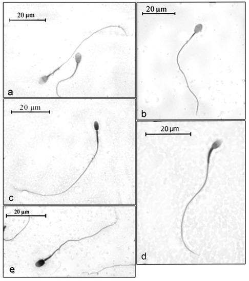 Three-dimensional reconstruction of the head of an adult sperm