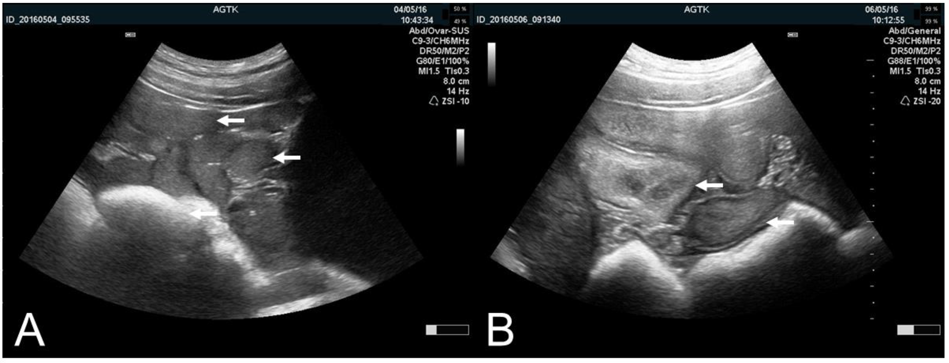 Animals Free Full Text Principles And Clinical Uses Of Real Time Ultrasonography In Female Swine Reproduction Html