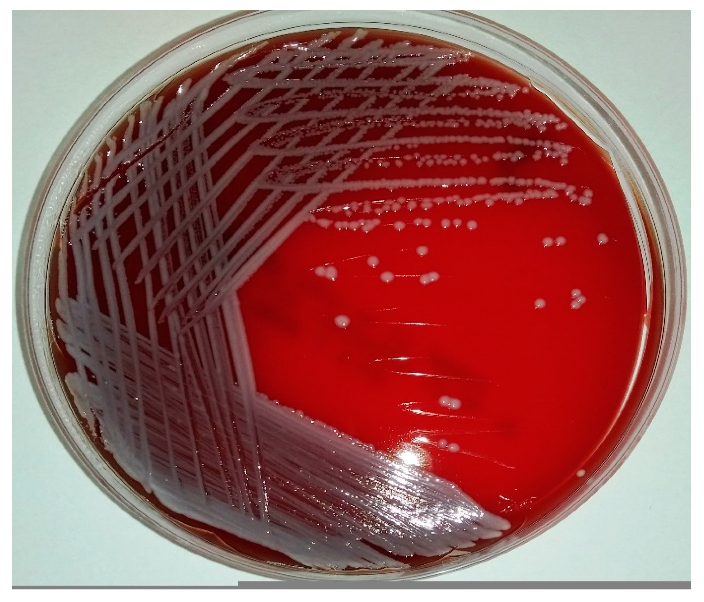 Staphylococcus: Most Up-to-Date Encyclopedia, News & Reviews