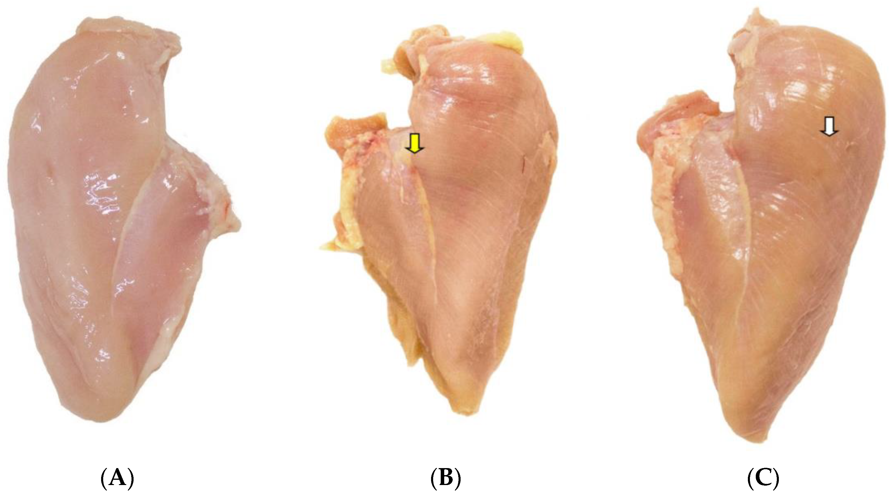 Is Wooden Breast syndrome simply another name for Chicken Diabetes ?