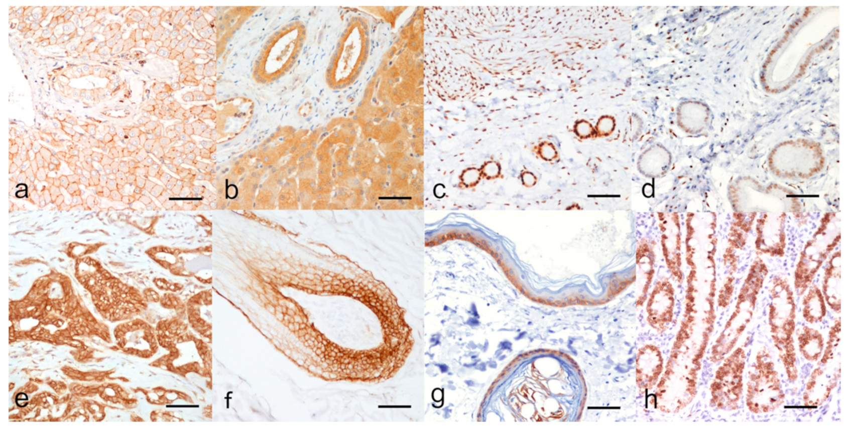 Animals | Free Full-Text | High Intrinsic Expression of P-glycoprotein and  Breast Cancer Resistance Protein in Canine Mammary Carcinomas Regardless of  Immunophenotype and Outcome | HTML