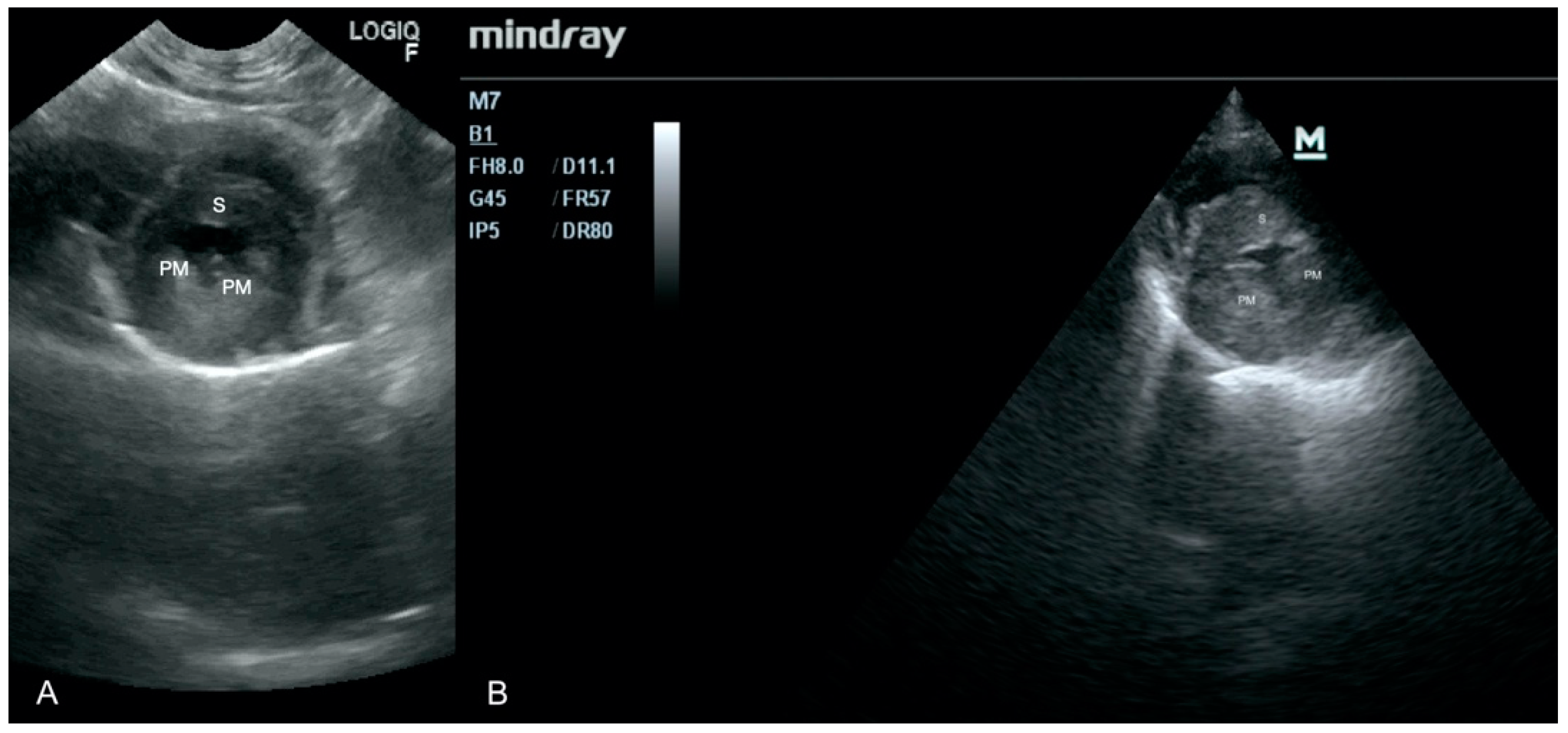 west valley women's care ultrasound