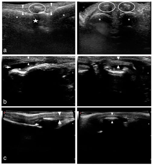 Animals | Free Full-Text | Common Digital Extensor Tendon Injury in ...