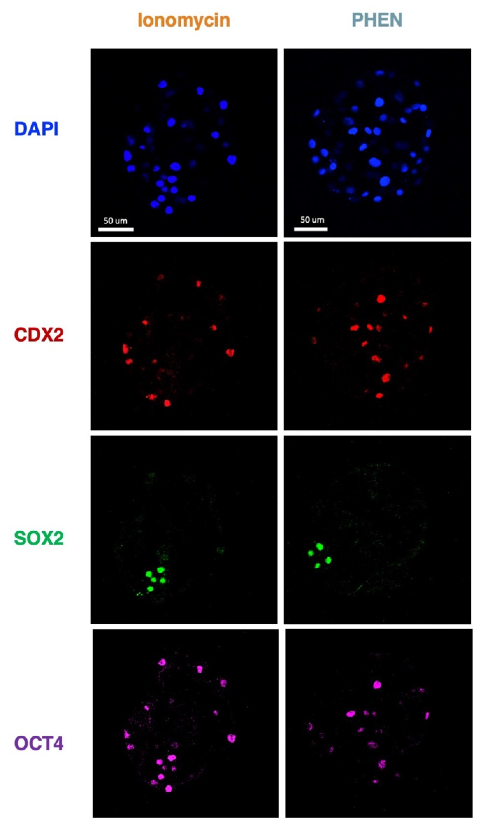 Animals | Free Full-Text | Preimplantation Developmental Competence of  Bovine and Porcine Oocytes Activated by Zinc Chelation