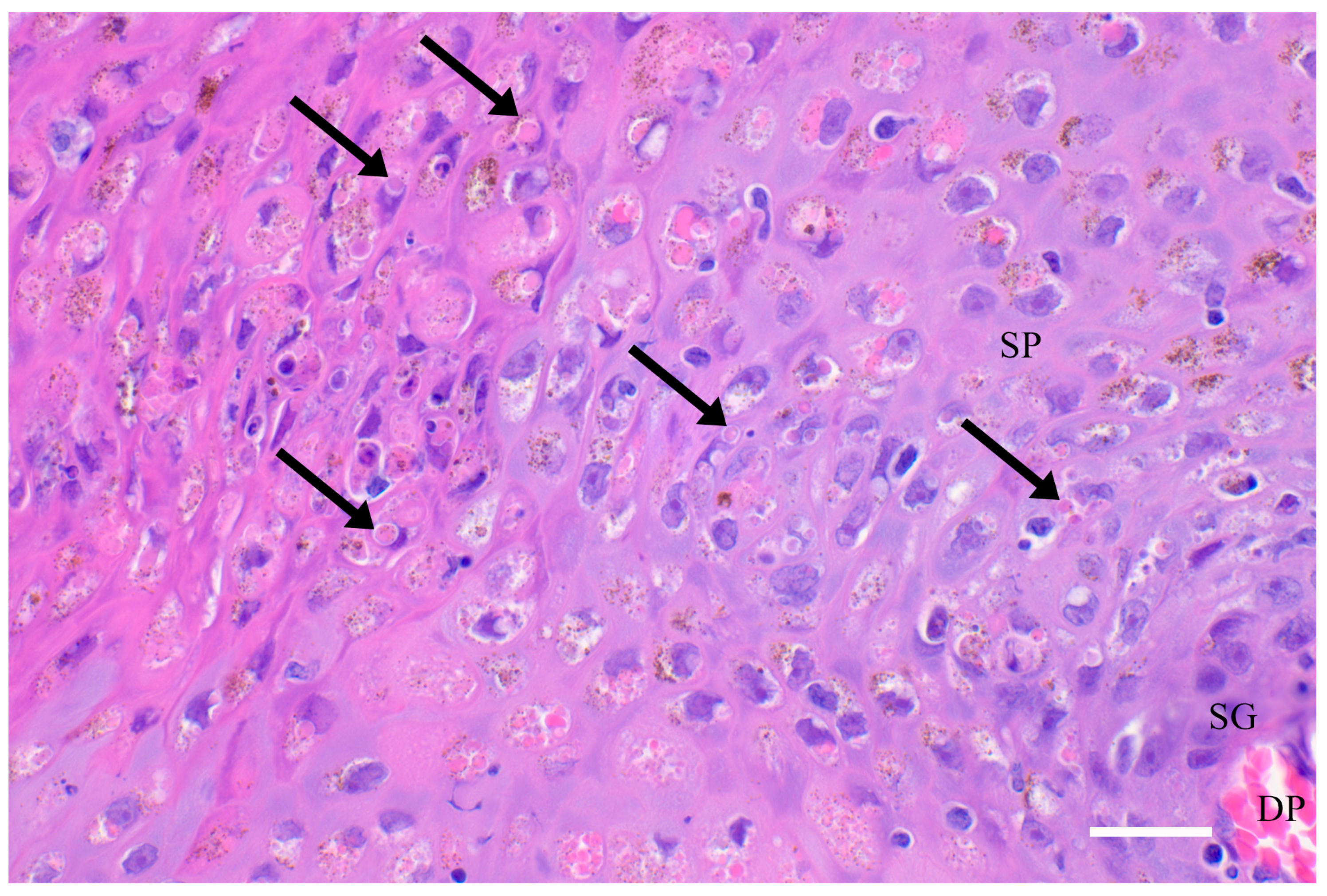 Dermatologic Signs of Systemic Disease