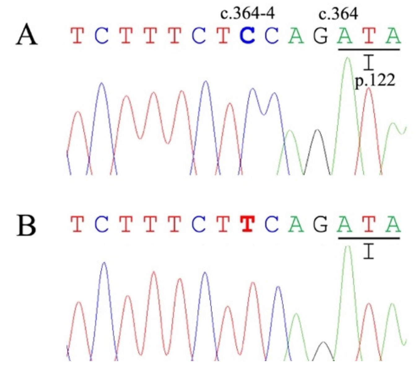 A new regulatory mechanism of STARD1 in Niemann-Pick disease type C (NPC),  discovered