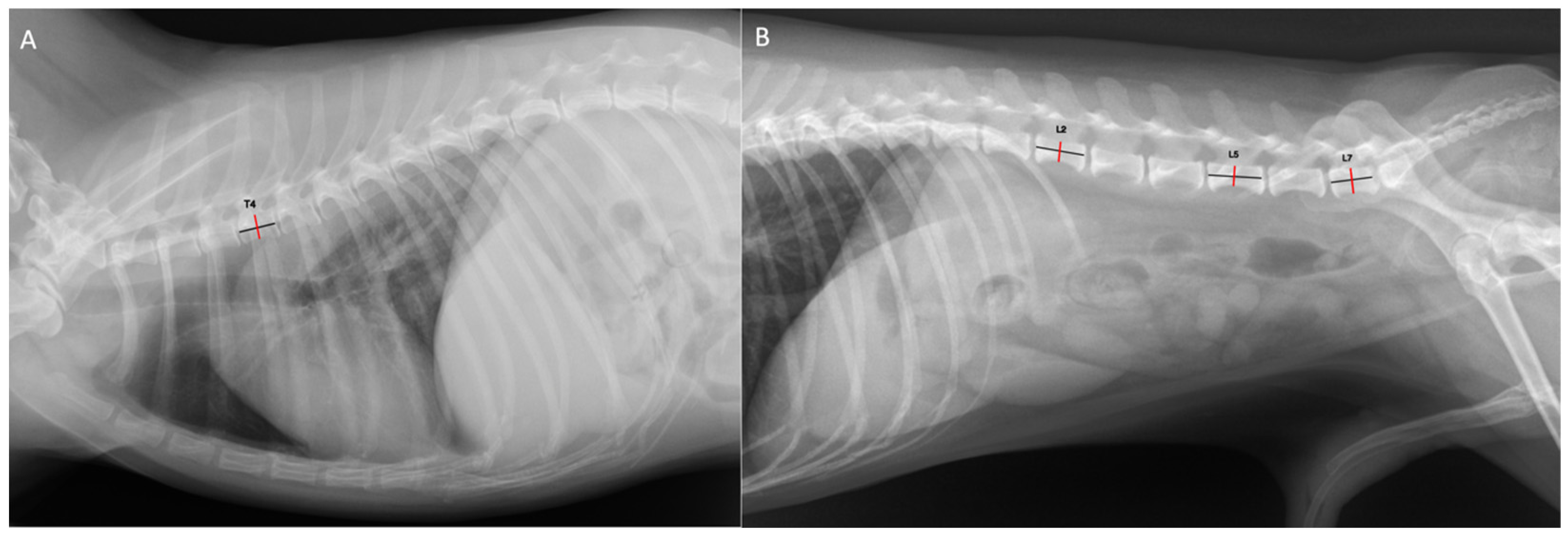 Medicine in pictures - Barrel chest . A barrel chest means a broad, deep  chest that resembles the shape of a barrel. A man with a barrel chest can  naturally have a