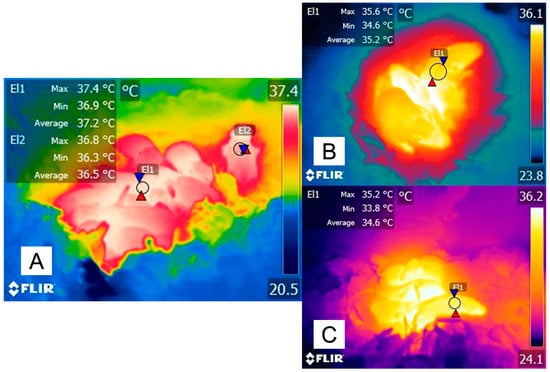 Functional role of peripheral vasoconstriction: not only thermoregulation  but much more