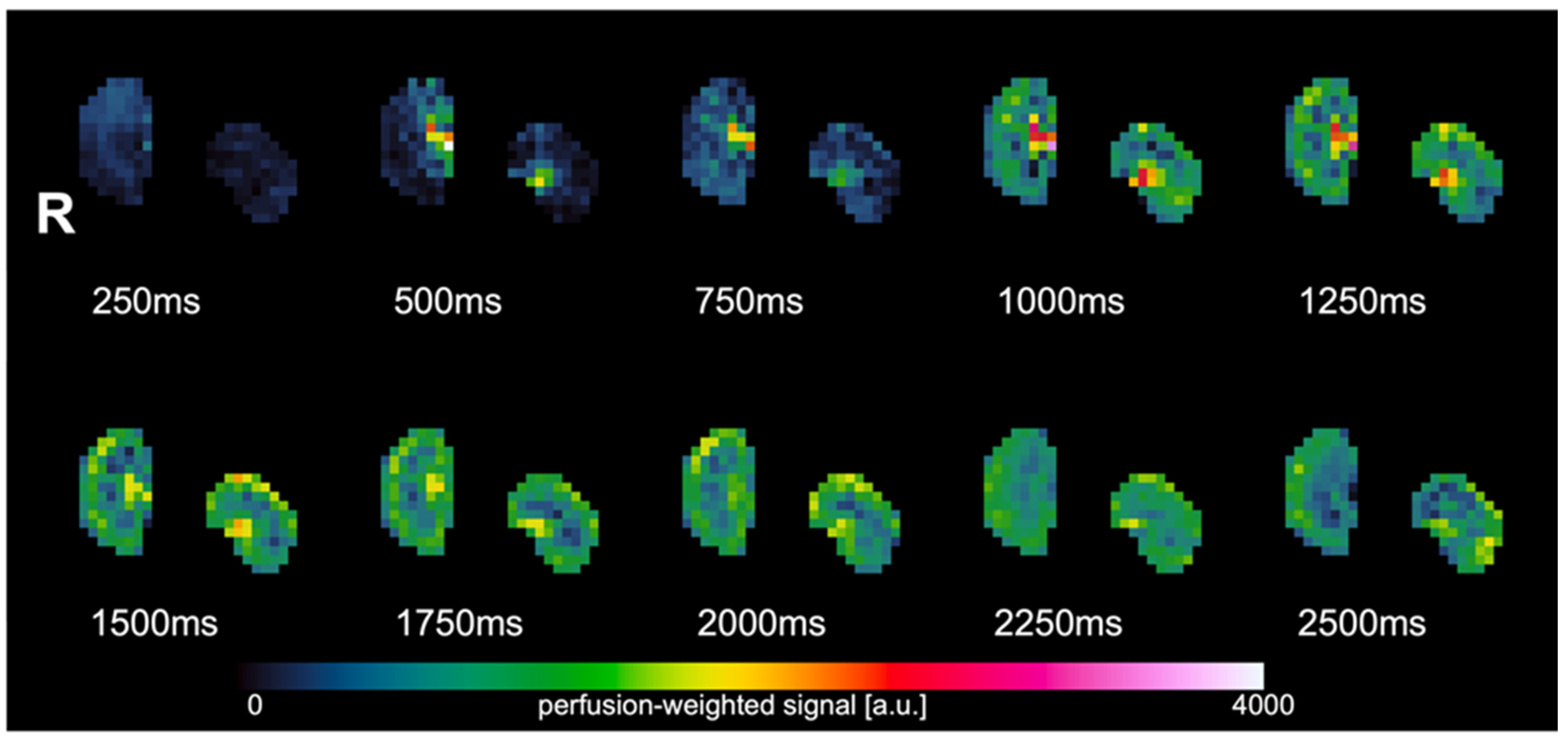 Animals | Free Full-Text | Optimization of Fair Arterial Spin Labeling ...