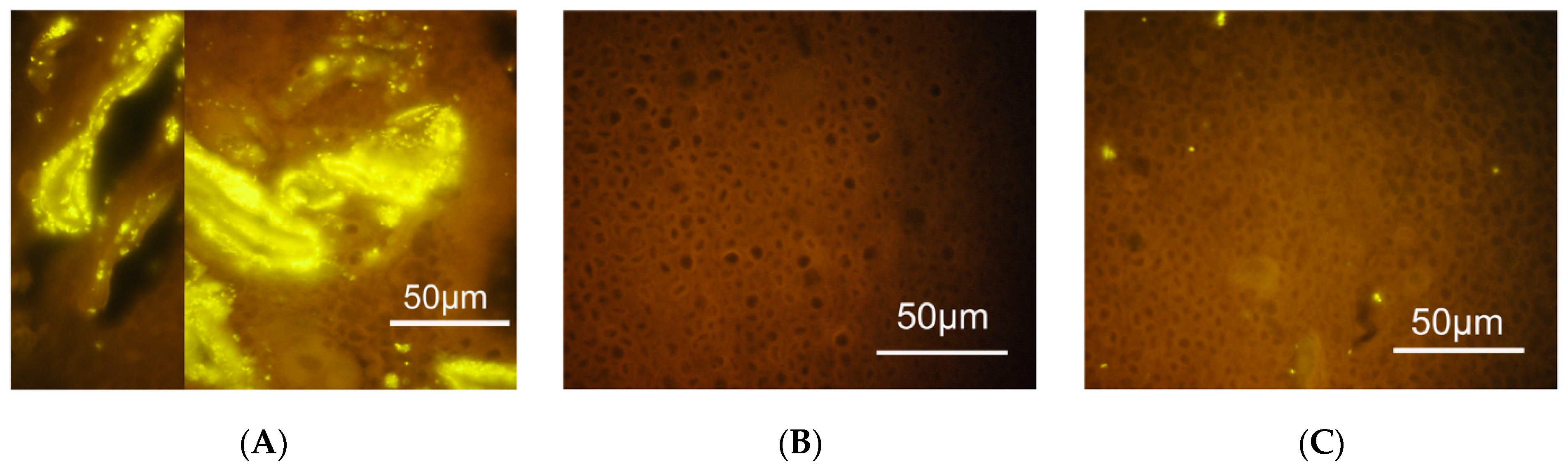 Antibiotics Free Full Text Bacterial Biofilm And Its Role In The Pathogenesis Of Disease Html