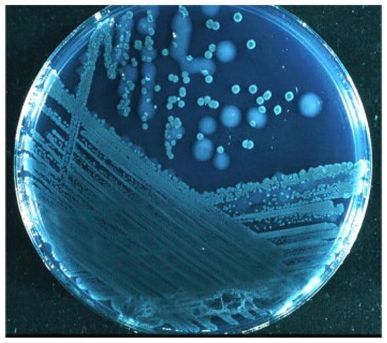 Antibiotics Free Full Text Bacterial Biofilm And Its Role In The Pathogenesis Of Disease Html