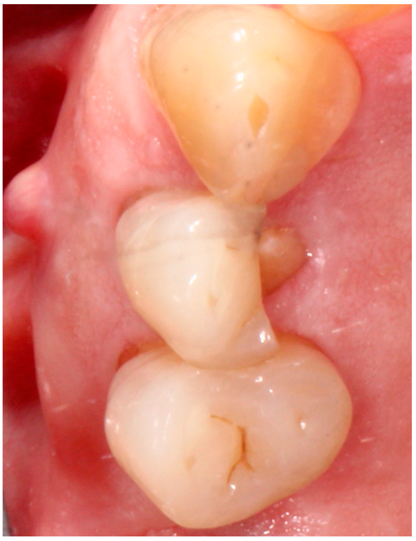 Antibiotics 09 00110 g001 Antibiotics 09 00110 g001