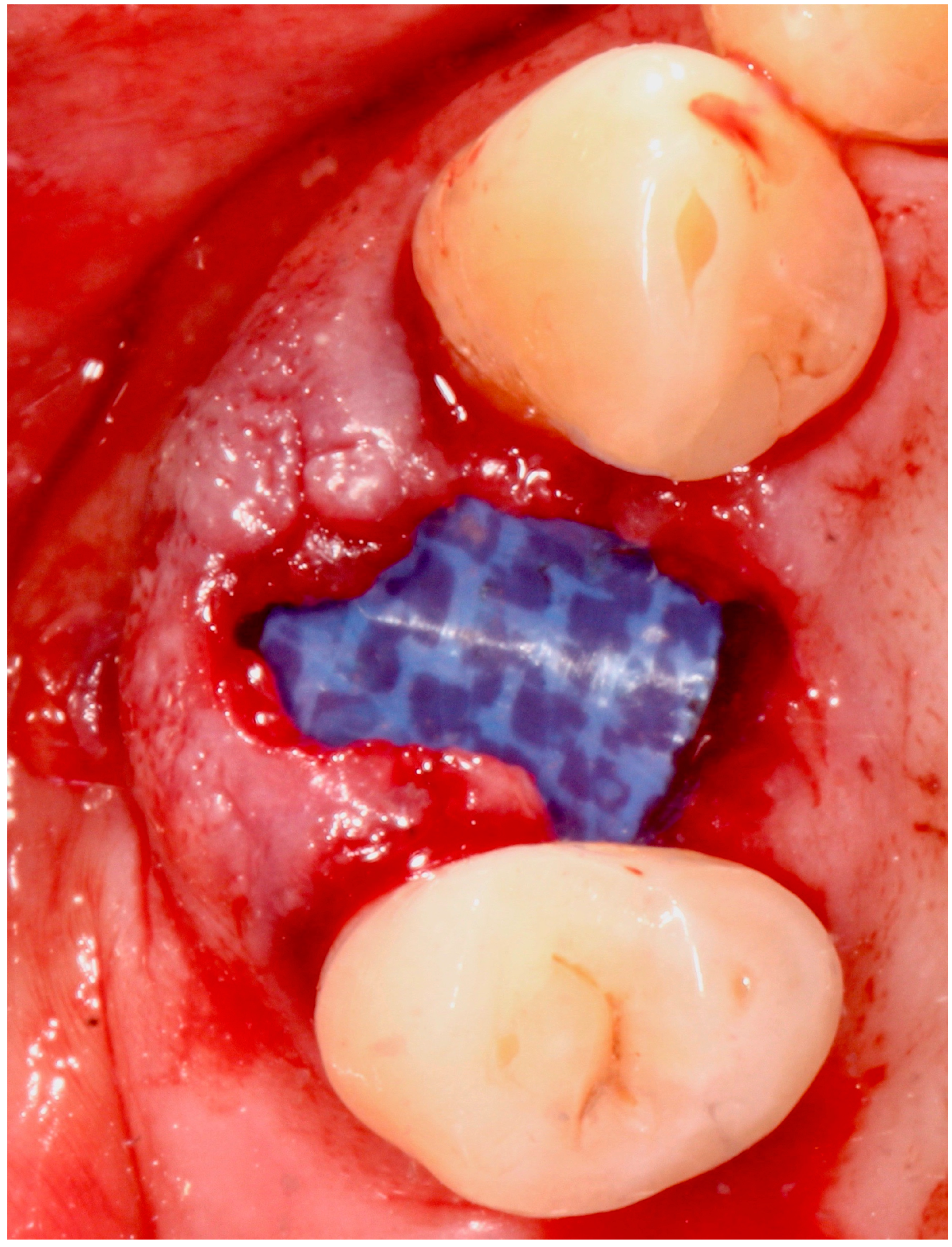 Antibiotics 09 00110 g003 Antibiotics 09 00110 g003