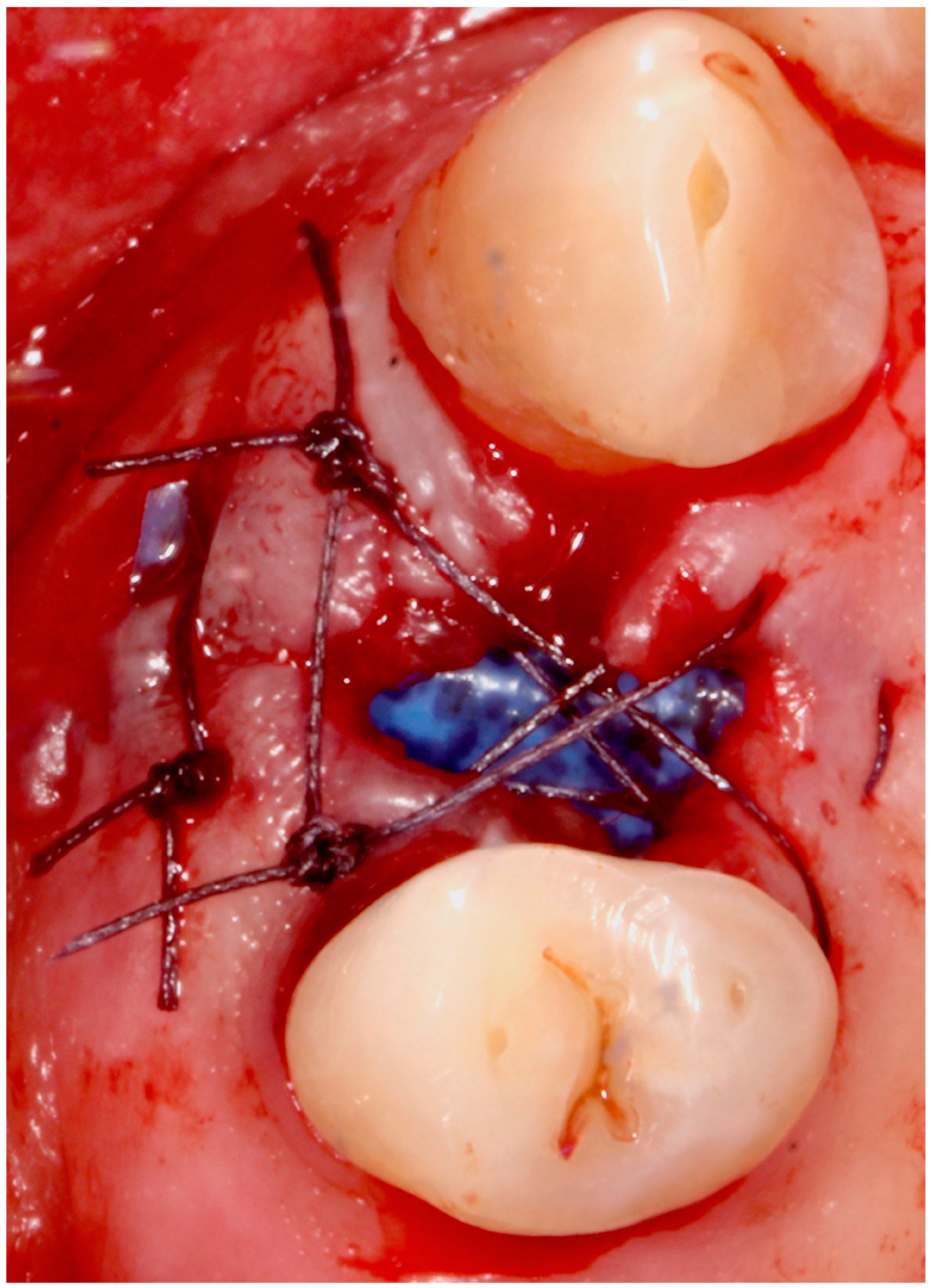 Antibiotics 09 00110 g004 Antibiotics 09 00110 g004