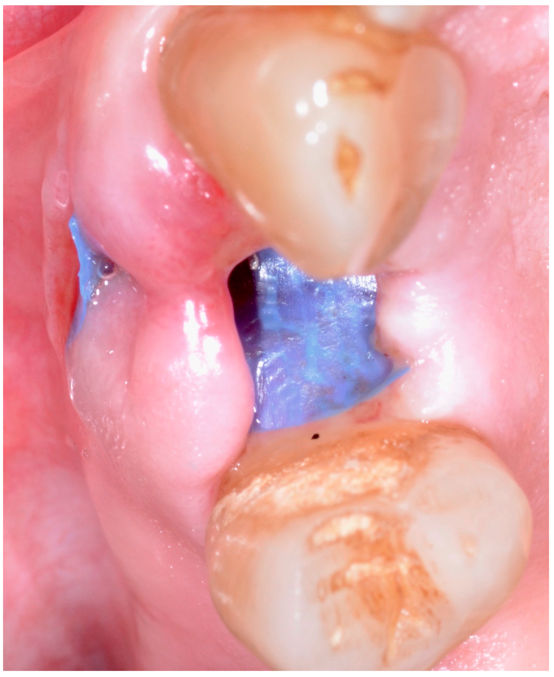 Antibiotics 09 00110 g005 Antibiotics 09 00110 g005