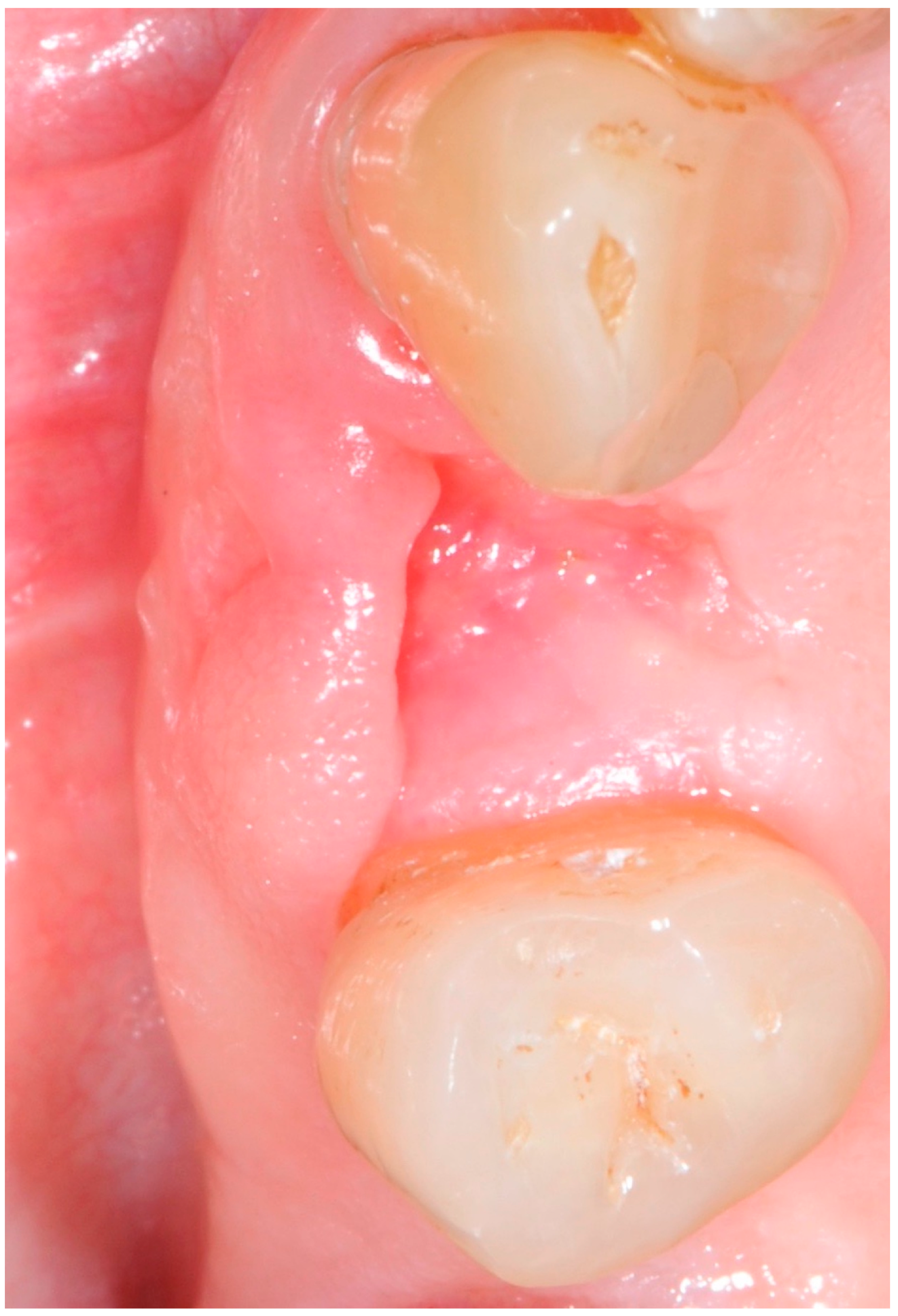 Antibiotics 09 00110 g006 Antibiotics 09 00110 g006