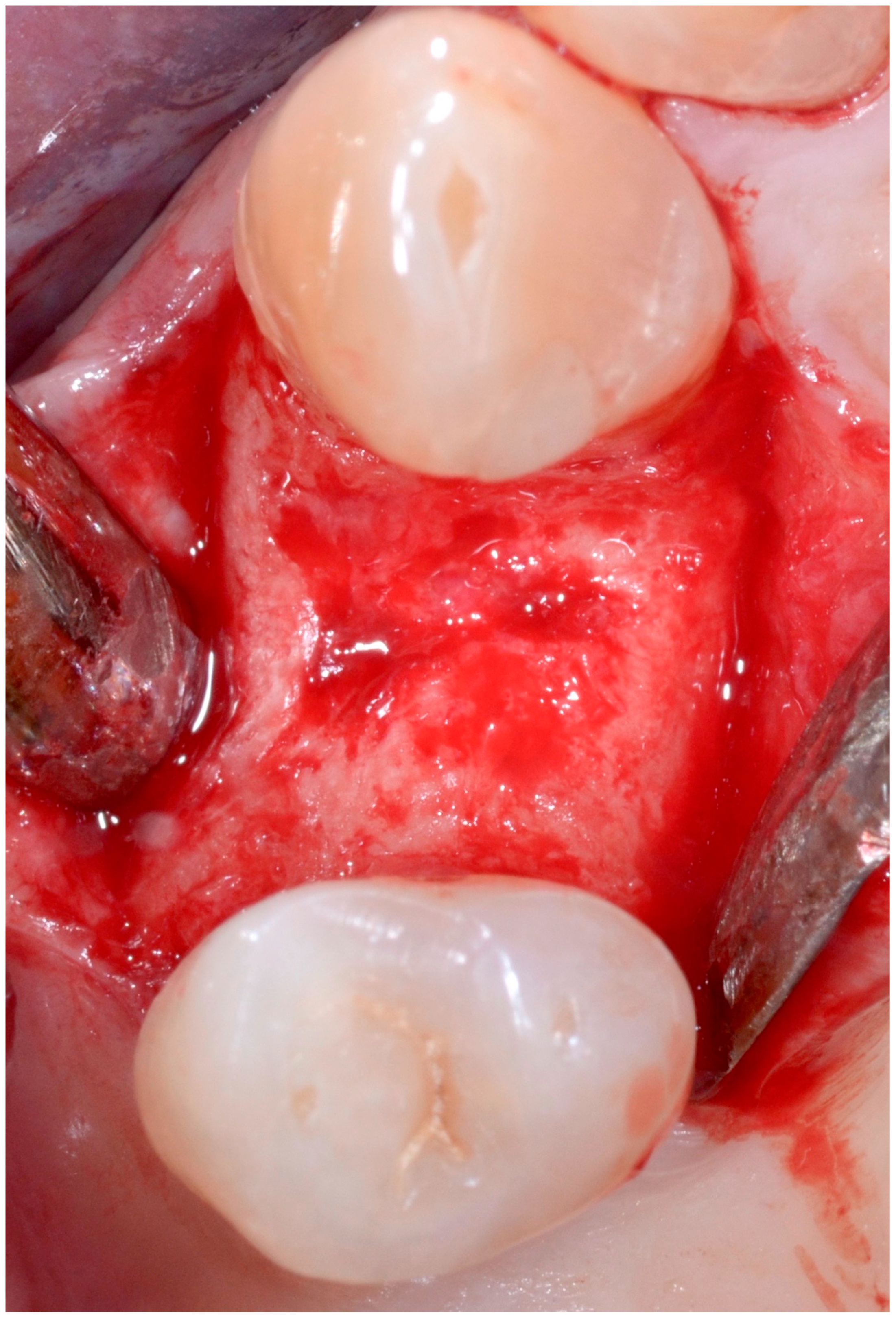 Antibiotics 09 00110 g007 Antibiotics 09 00110 g007
