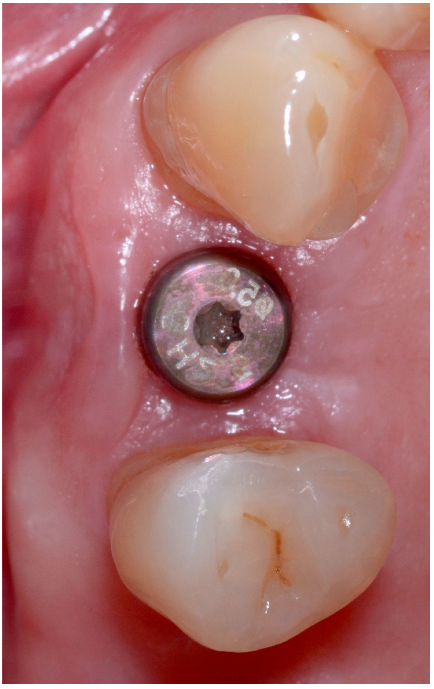 Antibiotics 09 00110 g009 Antibiotics 09 00110 g009