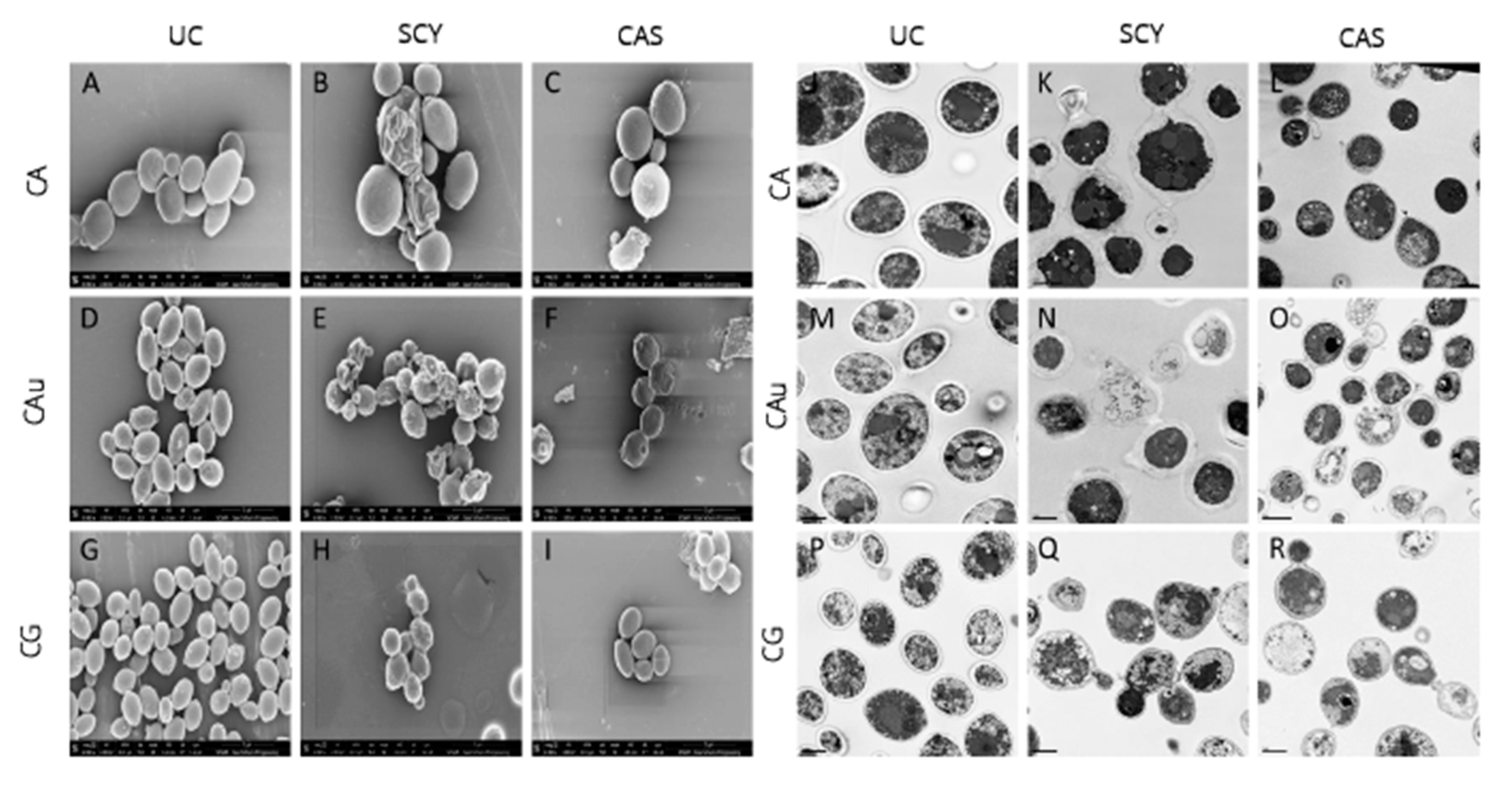 Antibiotics Free Full Text Ibrexafungerp A Novel Oral Triterpenoid Antifungal In Development For The Treatment Of Candida Auris Infections Html