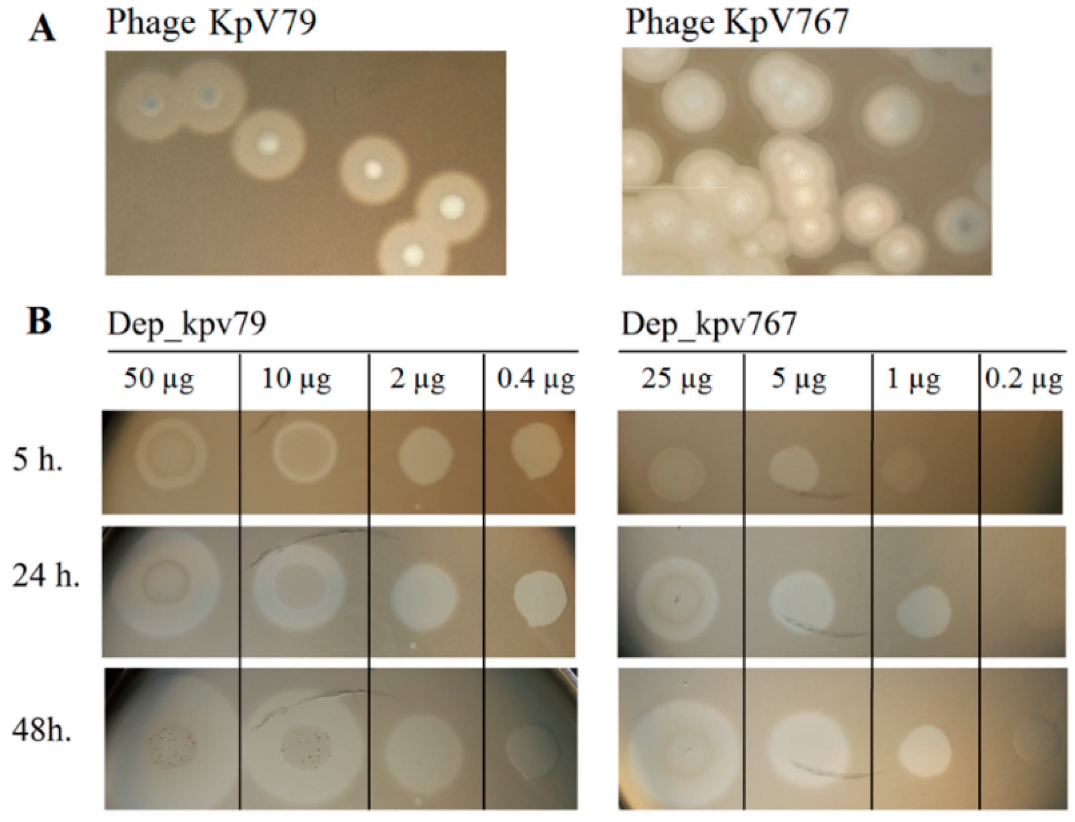 Antibiotics | Free Full-Text | Characterization and Therapeutic Potential  of Bacteriophage-Encoded Polysaccharide Depolymerases with β Galactosidase  Activity against Klebsiella pneumoniae K57 Capsular Type
