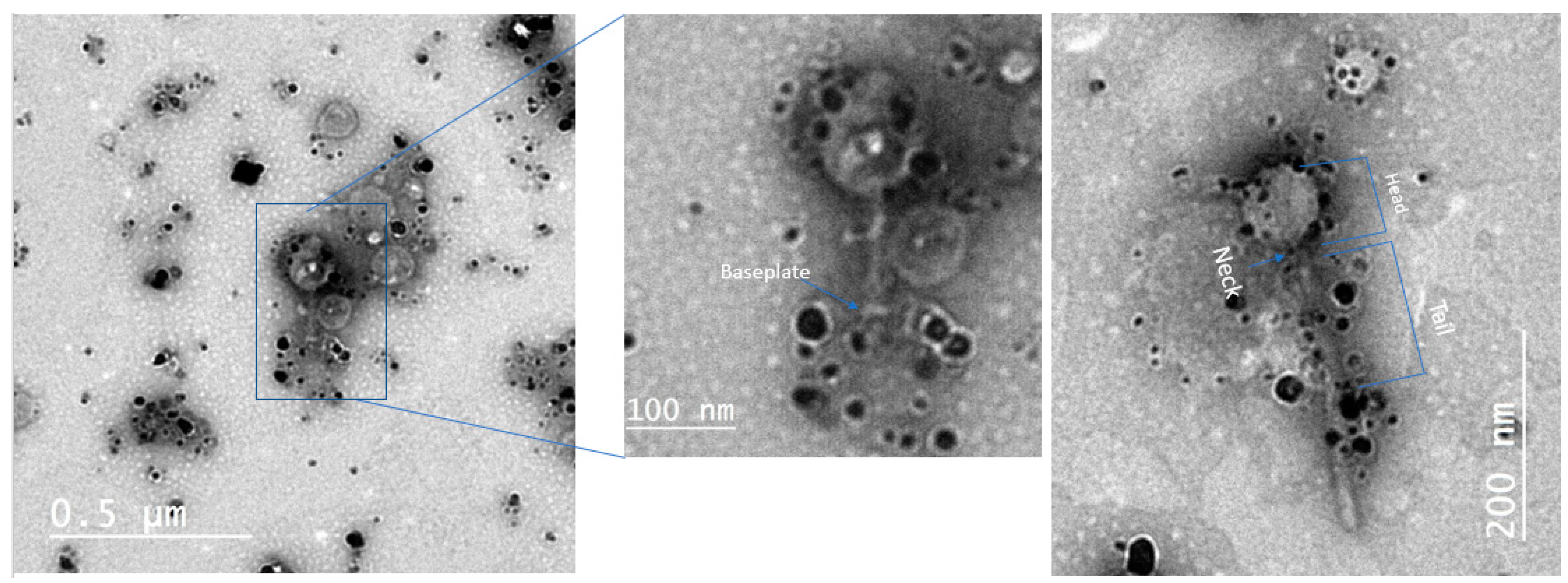 Antibiotics 10 00678 g004 Antibiotics 10 00678 g004