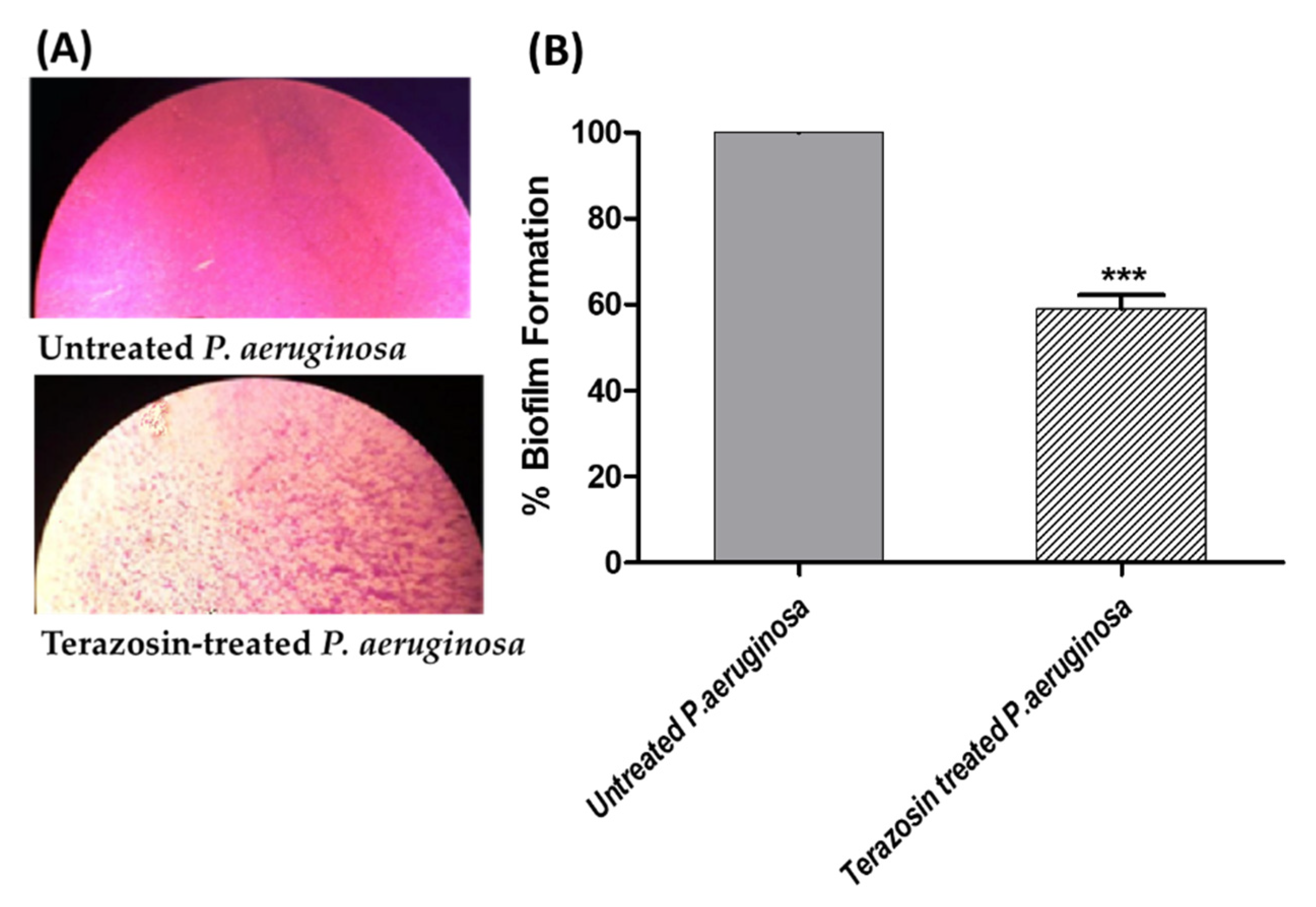 Antibiotics 11 00178 g012
