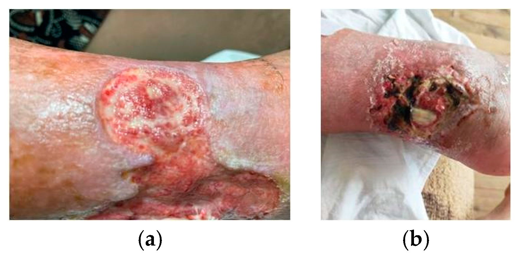 Antibiotics 14 00260 g004