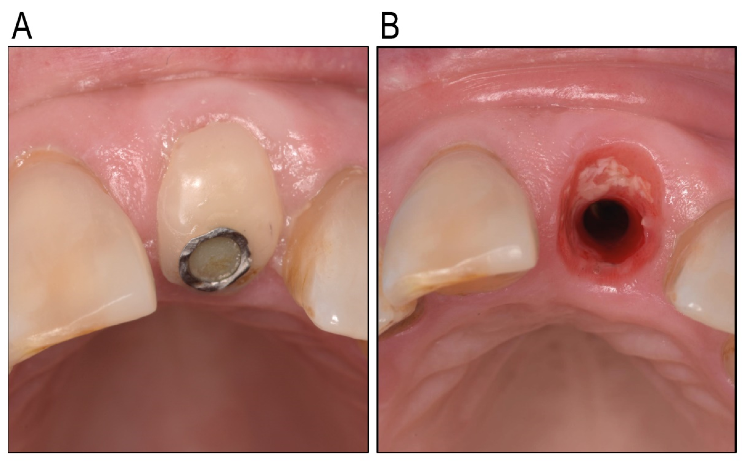 Antibiotics 14 00441 g005