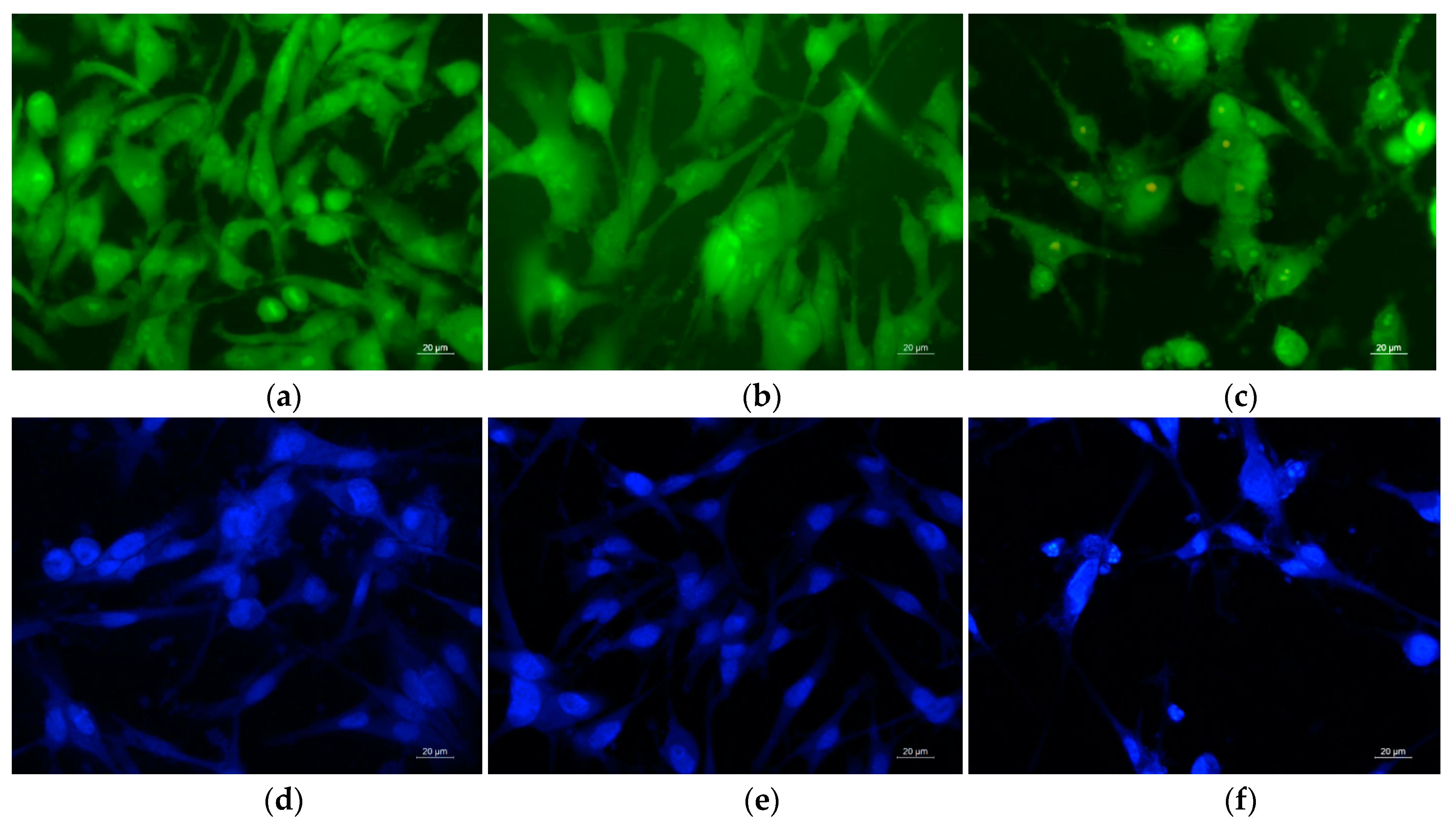 Antioxidants Free Full Text Antioxidant And Antitumor Activities Of Novel Quercetin Loaded Electrospun Cellulose Acetate Polyethylene Glycol Fibrous Materials Html