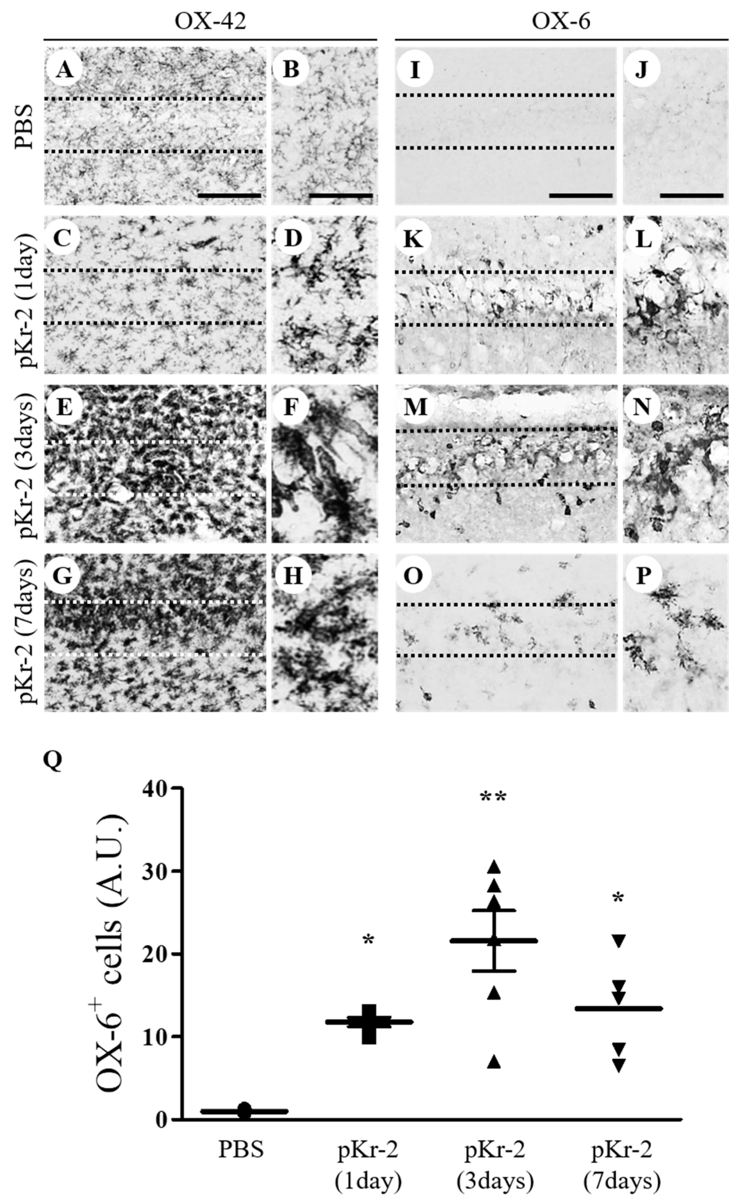 Antioxidants Free Full Text Interleukin 4 Mediated Oxidative Stress Is Harmful To Hippocampal Neurons Of Prothrombin Kringle 2 Lesioned Rat In Vivo Html