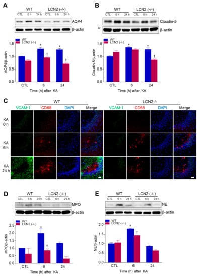 Antioxidants | Free Full-Text | Lipocalin-2 Deficiency Reduces ...