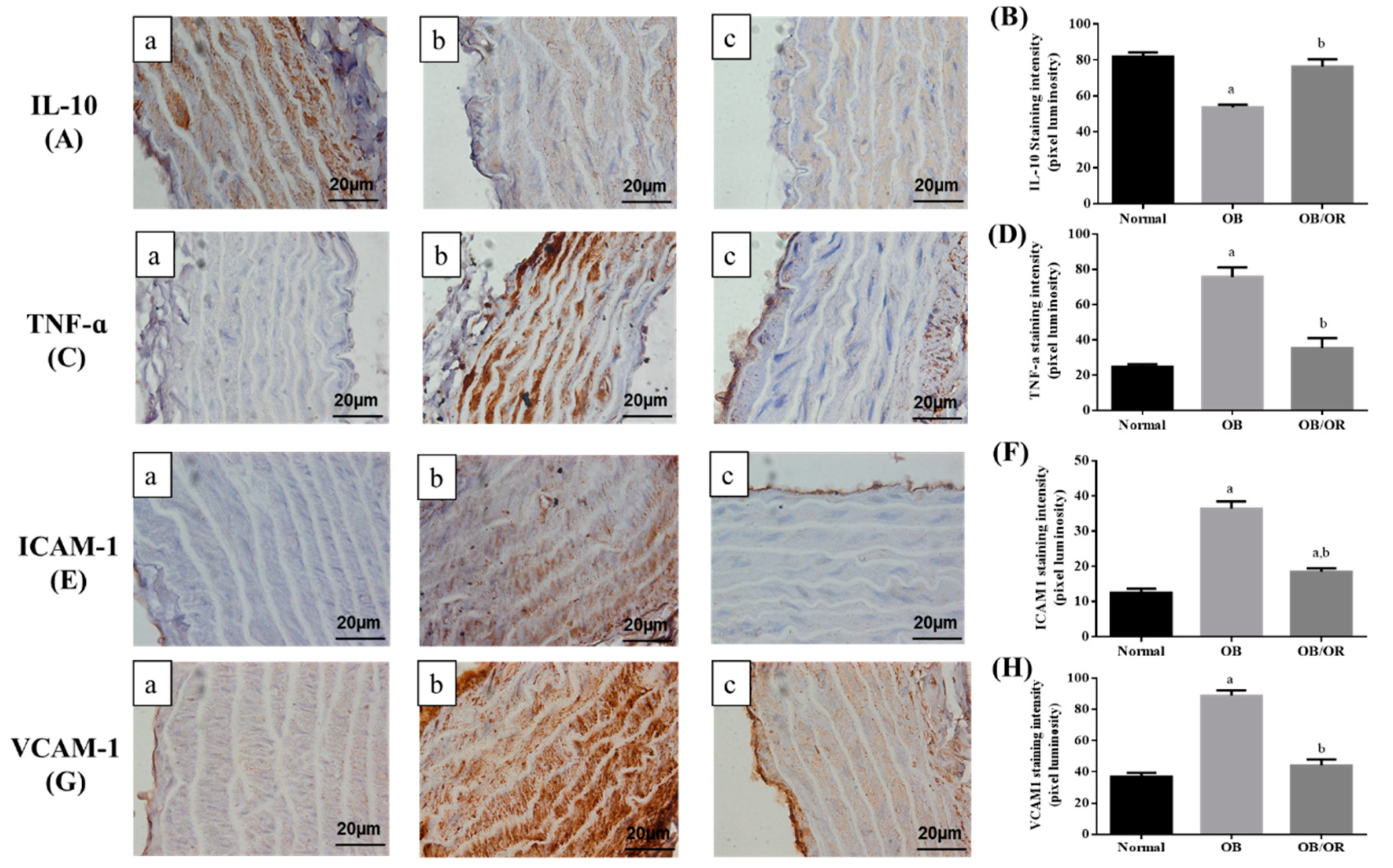 Antioxidants Free Full Text Anti Atherogenic Effects Of Orlistat On Obesity Induced Vascular Oxidative Stress Rat Model Html