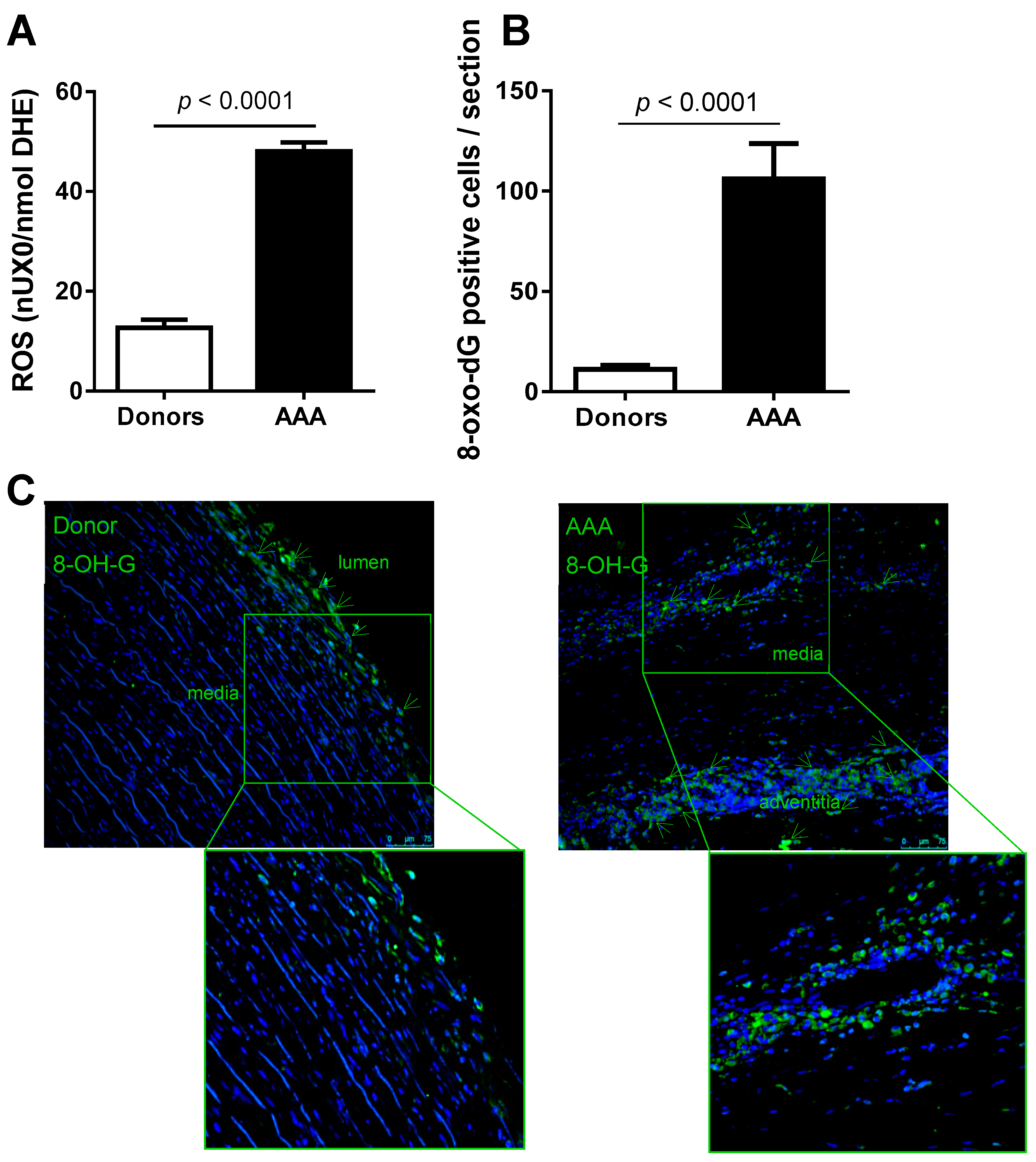 Antioxidants Free Full Text Oxidative Stress And Inflammatory Markers In Abdominal Aortic Aneurysm Html