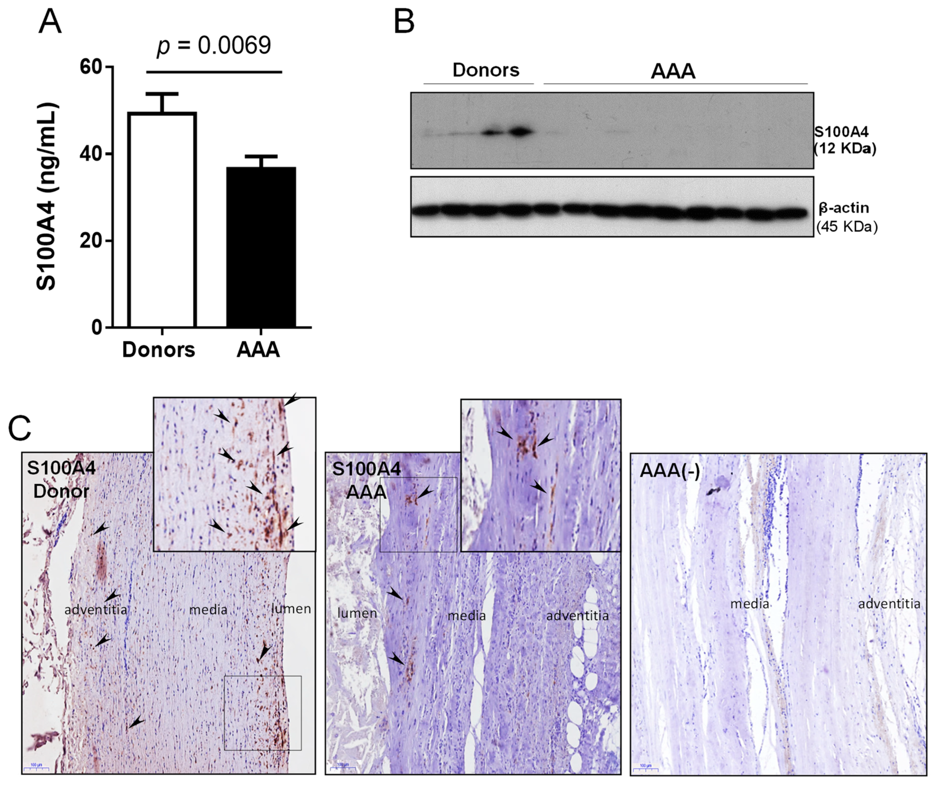 Antioxidants Free Full Text Oxidative Stress And Inflammatory Markers In Abdominal Aortic Aneurysm Html