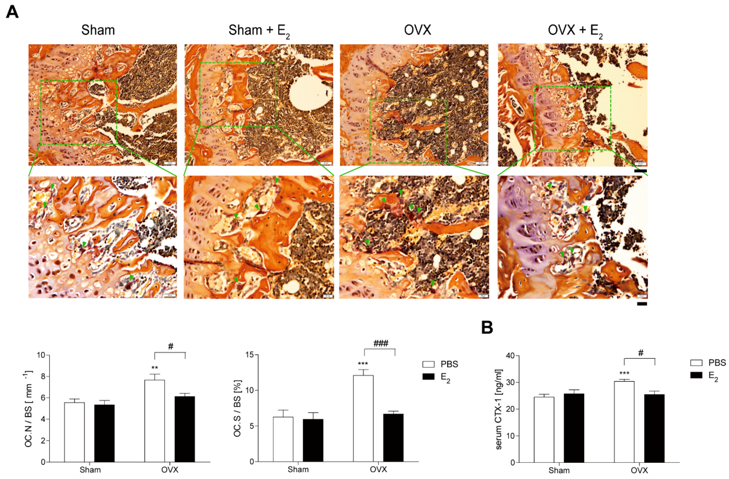 Antioxidants Free Full Text Estrogen Decreases Cytoskeletal Organization By Forming An Era Shp2 C Src Complex In Osteoclasts To Protect Against Ovariectomy Induced Bone Loss In Mice Html