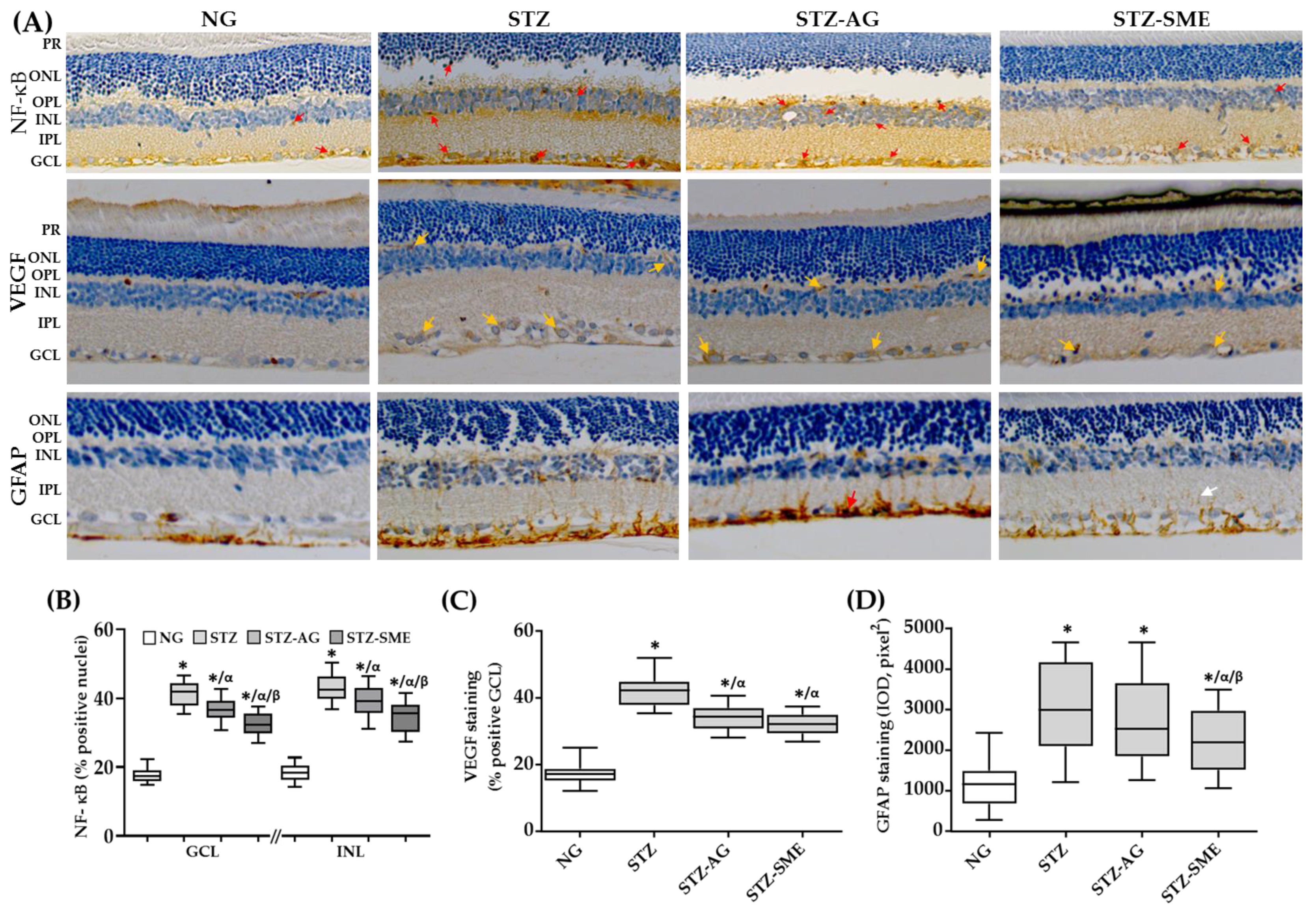 Antioxidants 10 00717 g004