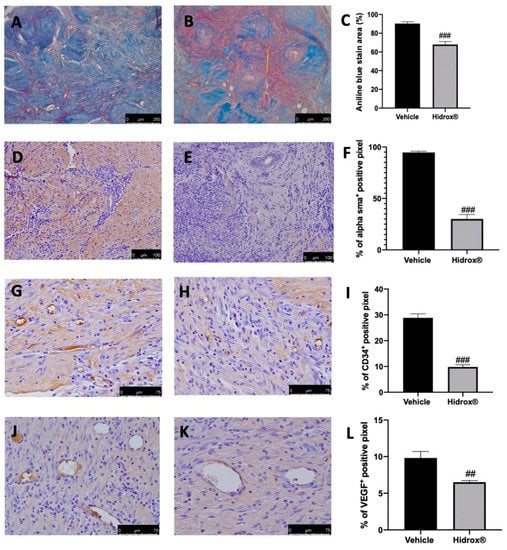 Antioxidants Free Full Text Hidrox And Endometriosis Biochemical Evaluation Of Oxidative Stress And Pain Html