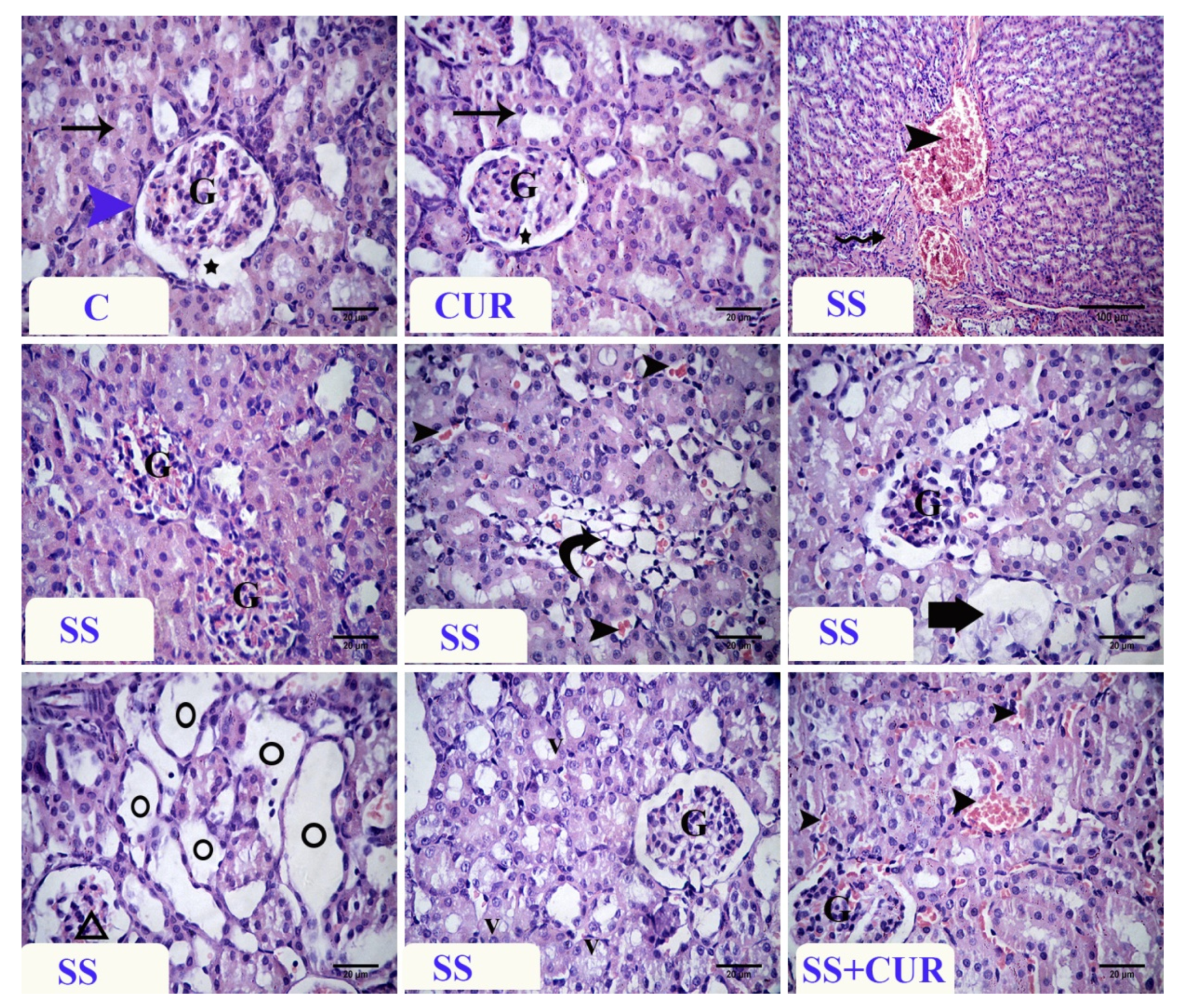 Antioxidants 10 00826 g003
