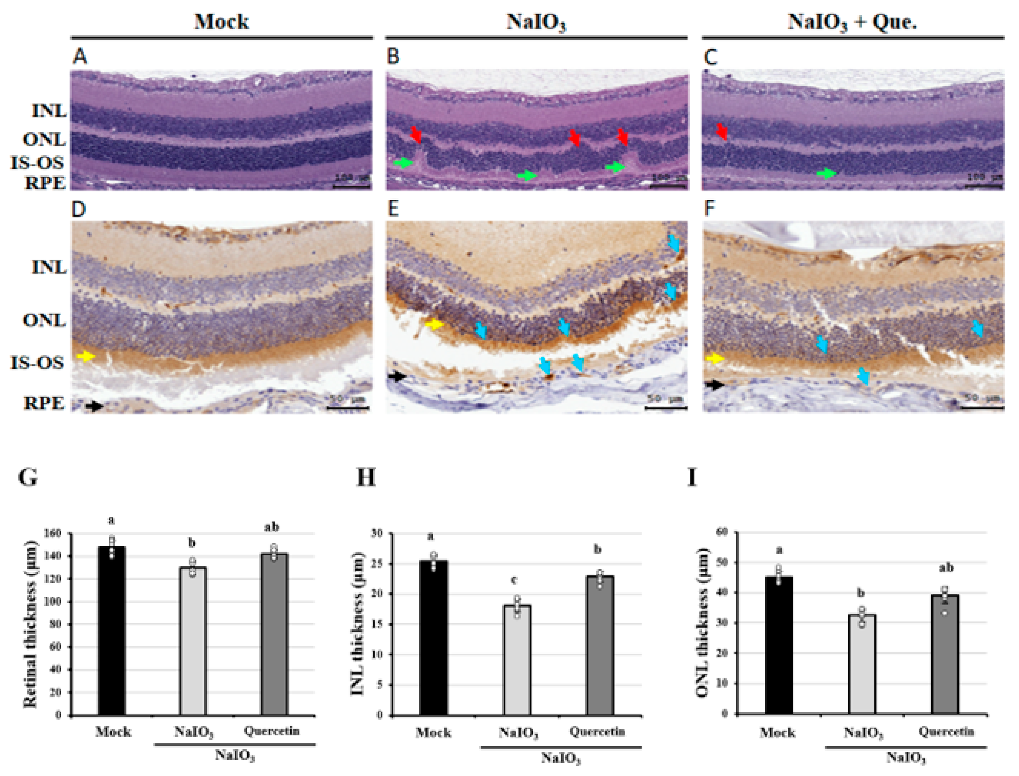 Antioxidants 10 01125 g001