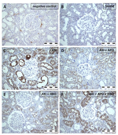 The intensity and extent of the NGAL immunostaining increased