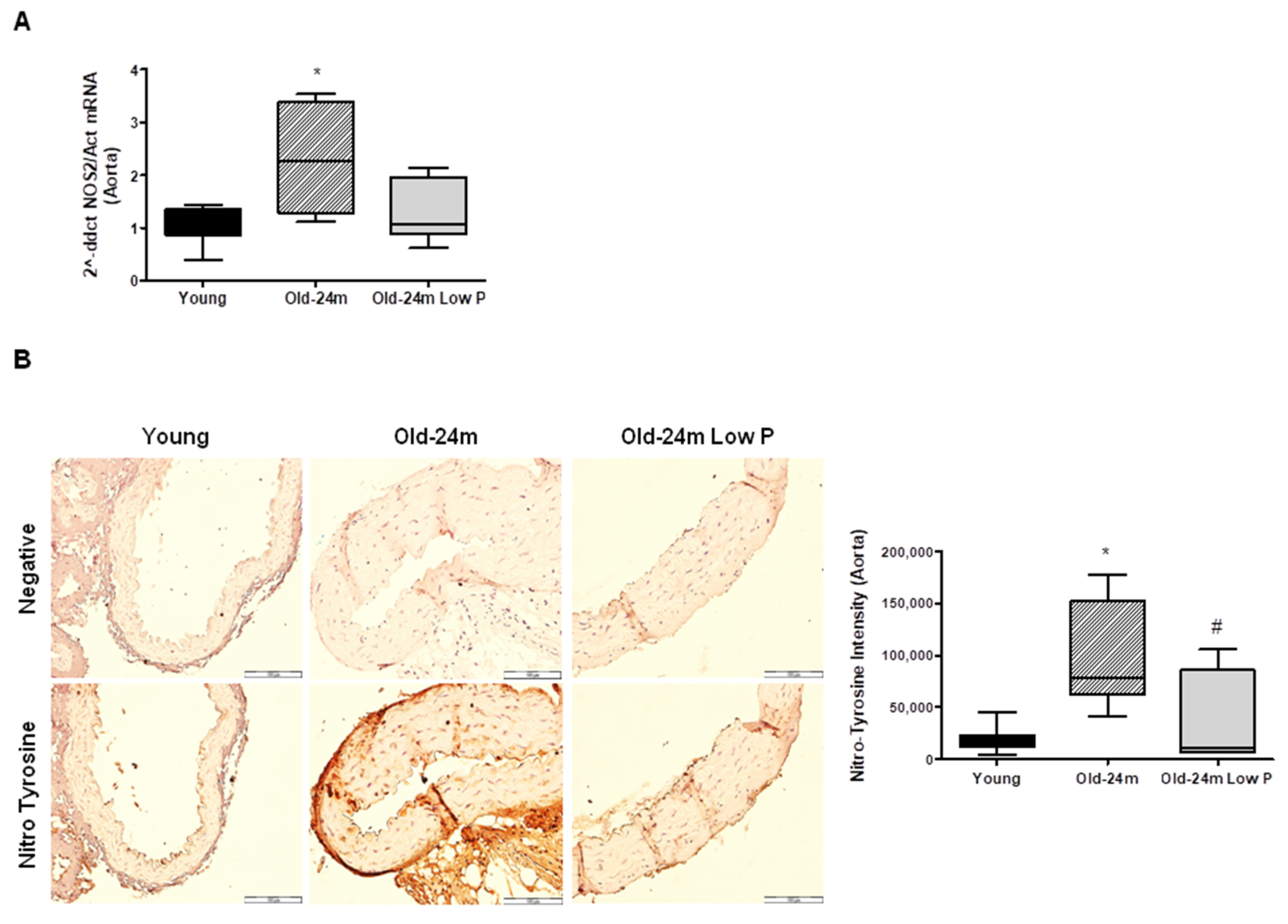Antioxidants | Free Full-Text | Hyperphosphatemia-Induced  Oxidant/Antioxidant Imbalance Impairs Vascular Relaxation and Induces  Inflammation and Fibrosis in Old Mice | HTML