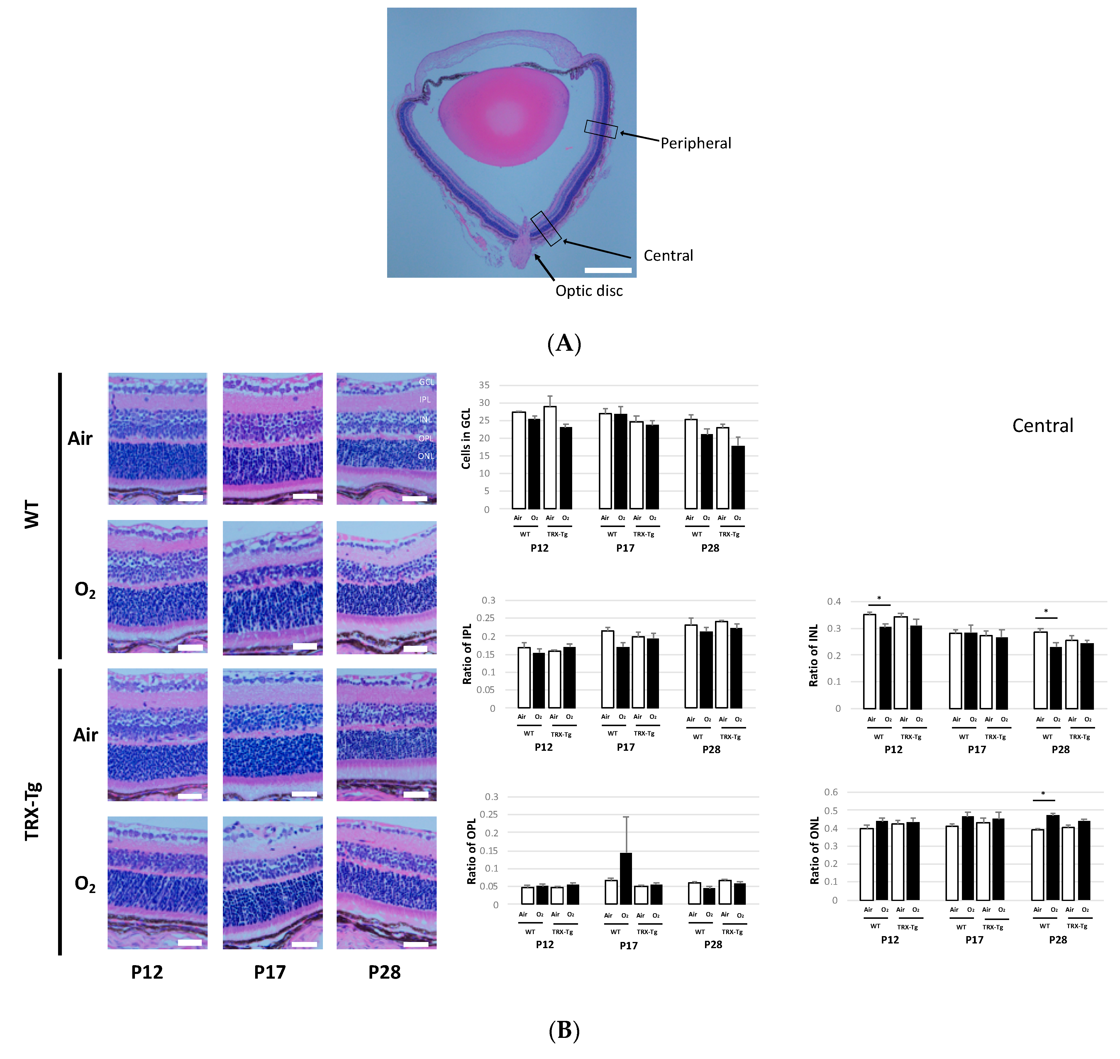 Antioxidants 11 00899 g006a