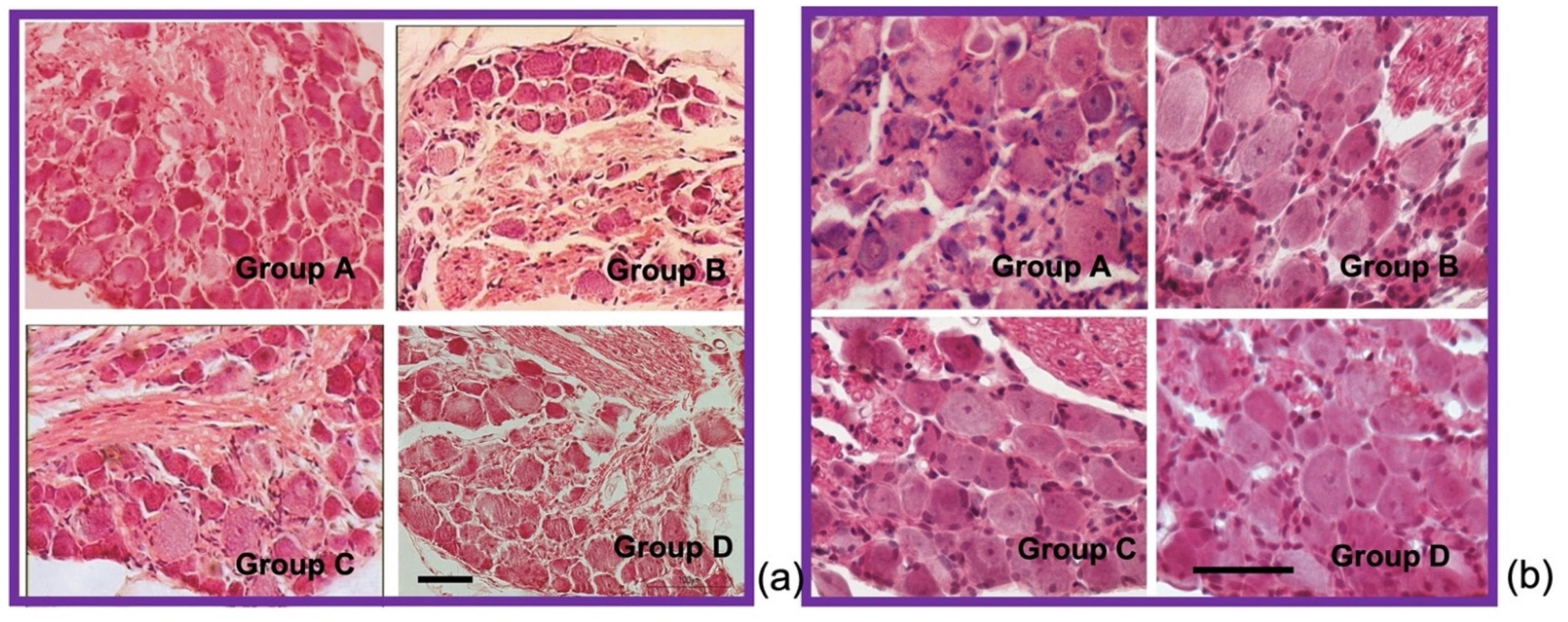 Antioxidants 11 01062 g004