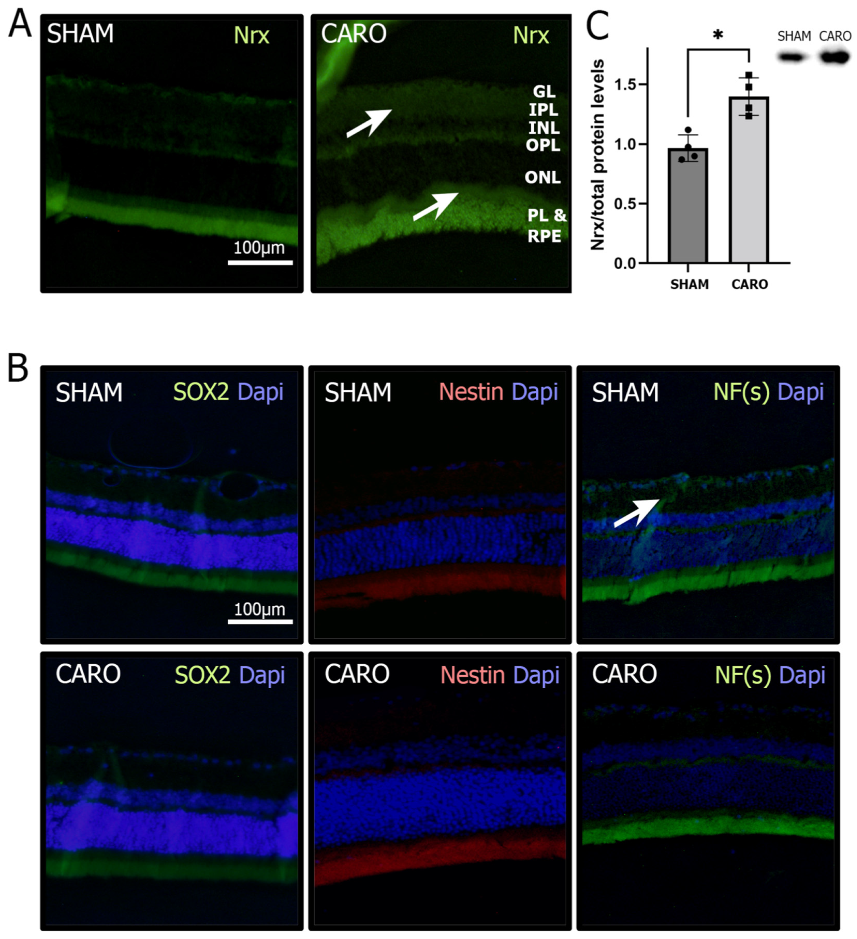 Antioxidants 11 01106 g001