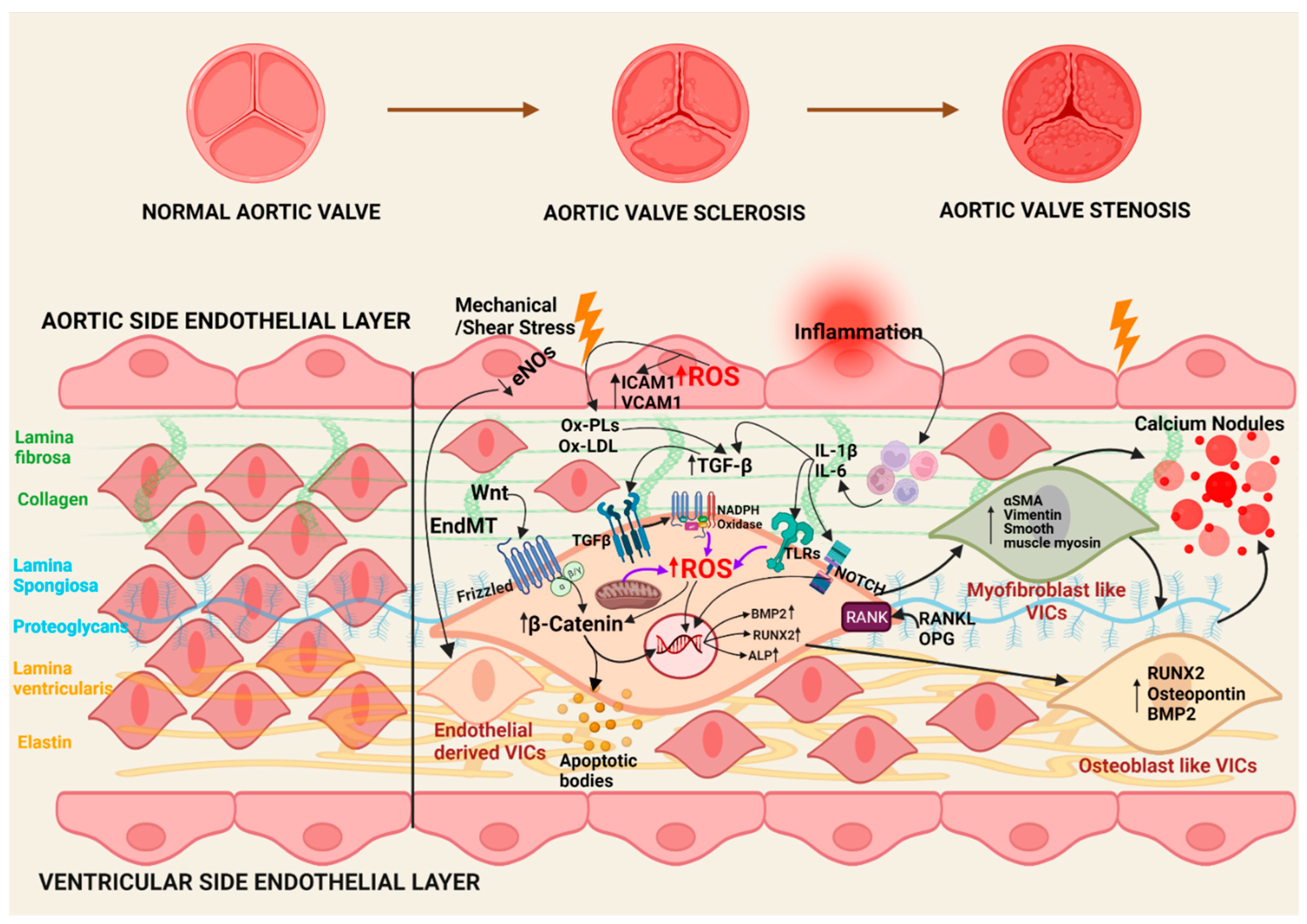 Antioxidants | Free Full-Text | Oxidative Stress in Calcific Aortic Valve  Stenosis: Protective Role of Natural Antioxidants