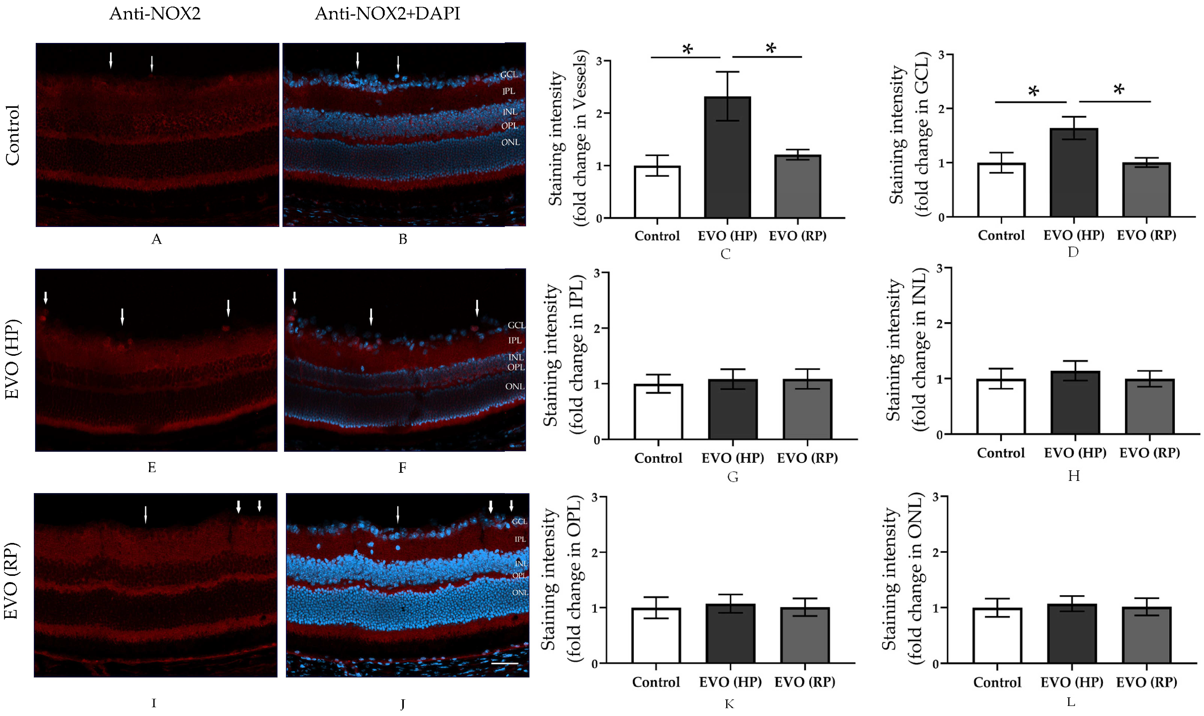 Antioxidants 11 01864 g004 Antioxidants 11 01864 g004
