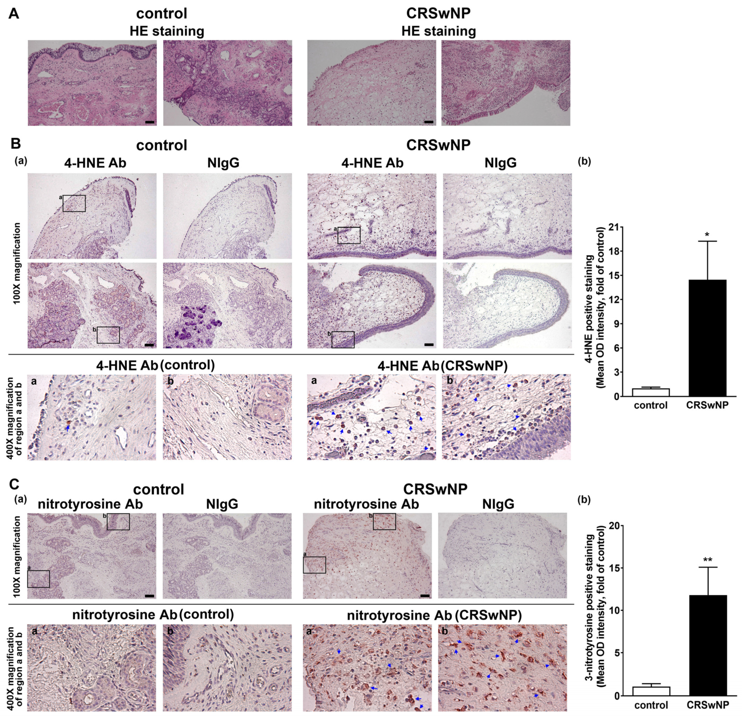 Antioxidants | Free Full-Text | Transcriptomic Analysis of Genes Associated  with Oxidative Stress in Chronic Rhinosinusitis Patients with Nasal Polyps:  Identifying Novel Genes Involved in Nasal Polyposis