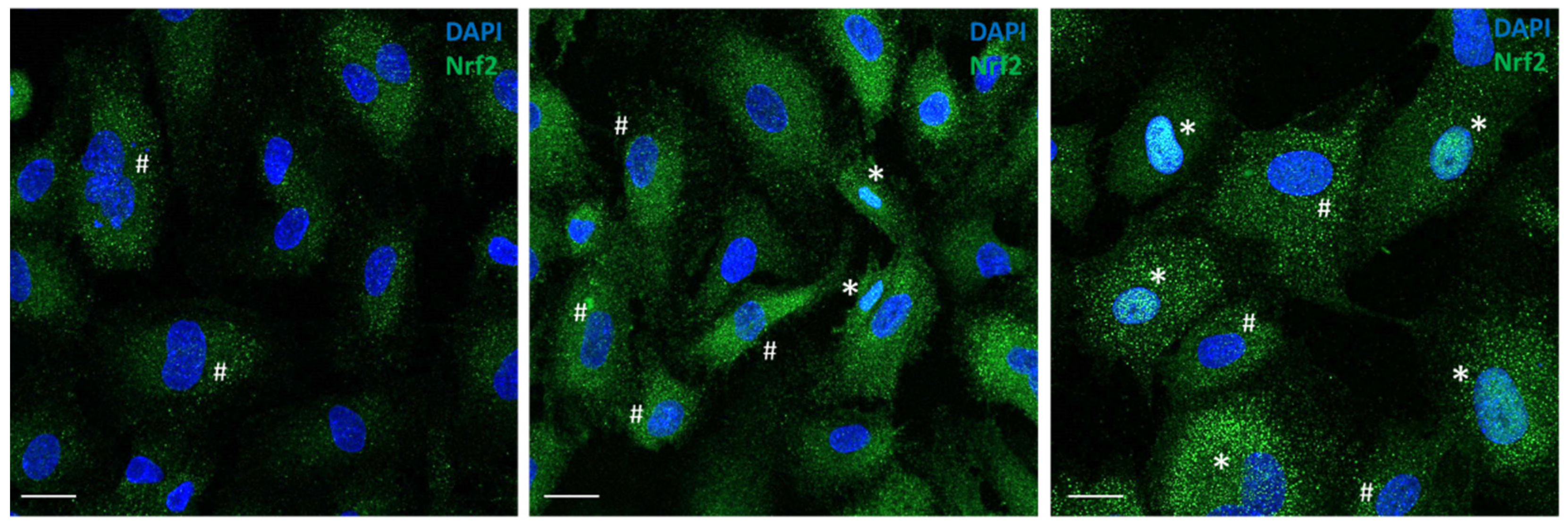 Antioxidants 11 01924 g004 Antioxidants 11 01924 g004