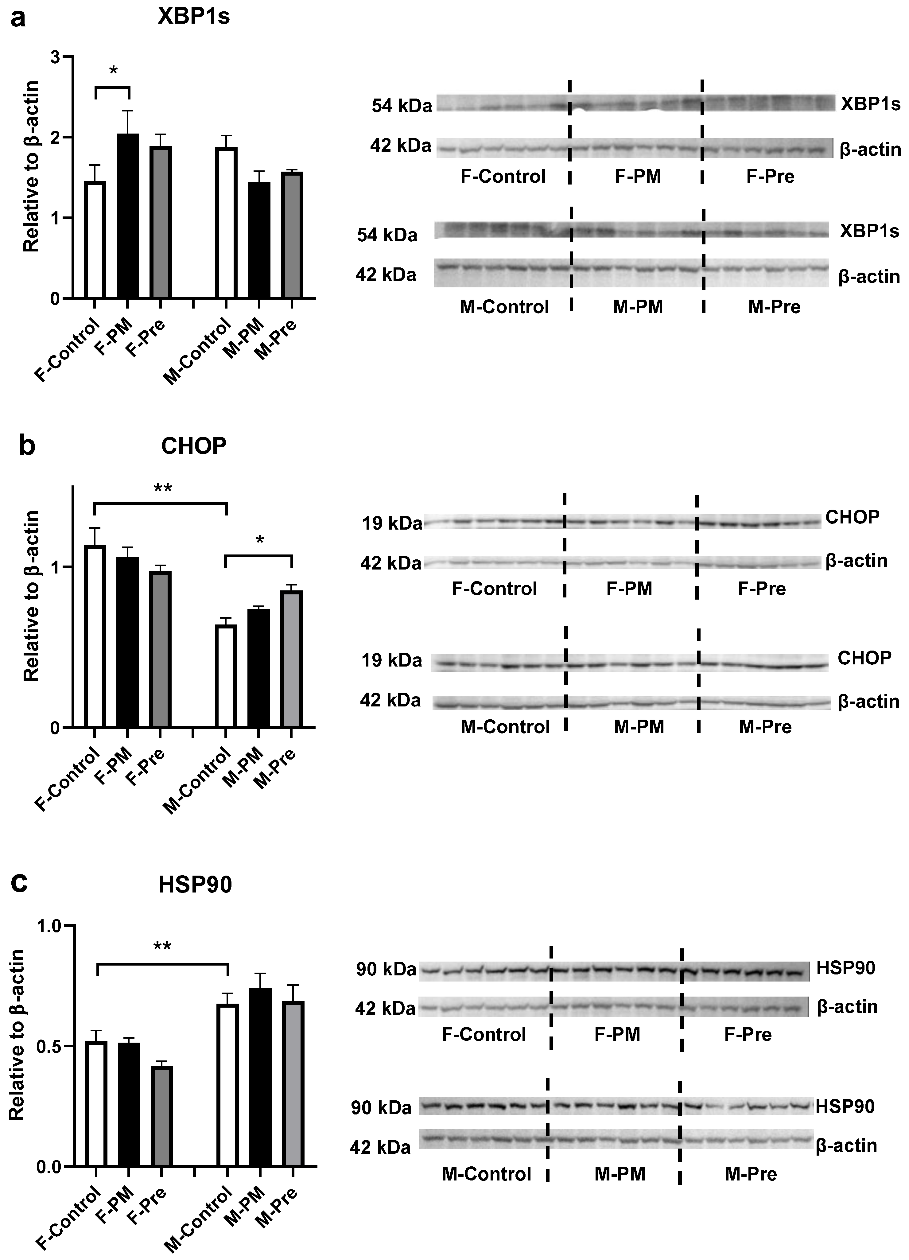 Antioxidants Free Full Text Sex Dependent Responses To Maternal